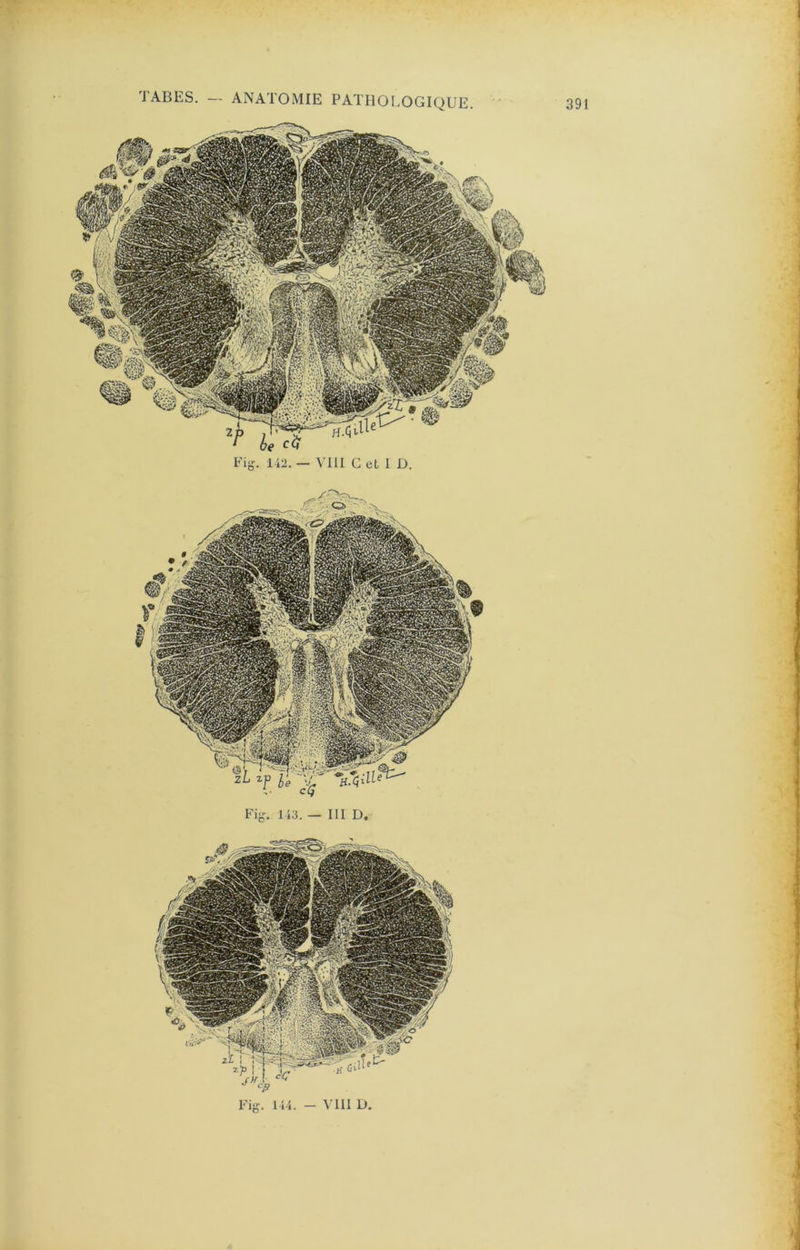 I TABES. — ANATOMIE PATHOLOGIQUE.
