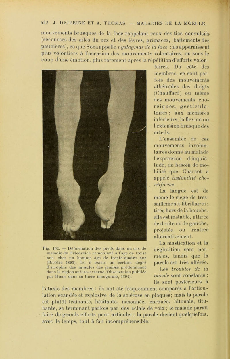 moiivemeiîls brusques de la face rappelant ceux des tics convulsifs (secousses des ailes du nez et des lèvres, grimaces, battements des paupières), ce ([uc Soca appelle nystagmiis de la face : ils apparaissent plus volontiers à l’occasion des mouvements volontaires, ou sous le coup d’une émotion, plus rarement après la répétition d’efforts volon- taires. Du côté des membres, ce sont par- fois des mouvements athétoïdes des doigts (Chaulfard) ou môme des mouvements cho- réiques, gesticula- toires ; aux membres inférieurs, la flexion ou l’extension brusque des orteils. L’ensemble de ces mouvements involon- taires donne au malade l’expression d’inquié- tude, de besoin de mo- bilité que Charcot a appelé inslabililé cho- réiforme. La langue est de môme le siège de tres- saillements fibrillaires ; tirée hors de la bouche, elle est instable, attirée de droite ou de gauche, projetée ou rentrée alternativement. La mastication et la déglutition sont nor- males, tandis que la parole est très altérée. Les troubles de la uarole sont constants : ils sont postérieurs à l’ataxie des membres ; ils ont été fréquemment comparés à l’articu- lation scandée et explosive de la sclérose en plaques; mais la parole est plutôt traînante, hésitante, nasonnée, enrouée, bitonale, titu- bante, se terminant parfois par des éclats de voix; le malade paraît faire de grands efforts pour articuler; la parole devient quelquefois, avec le temps, tout à fait incompréhensible. Fi de f,. 162. — Dérornialiun des pieds dans un cas maladie de Friedieich rcmonlanL à l’âge de treize ans, chez un homme âgé de trente-quatre ans (Bicêtre 1893). Ici 11 de existe un certain degré d'atrophie des muscles des jambes prédominant dans la région antéro-externe (Observation publiée par Ridel dans sa thèse inaugurale, 1891).
