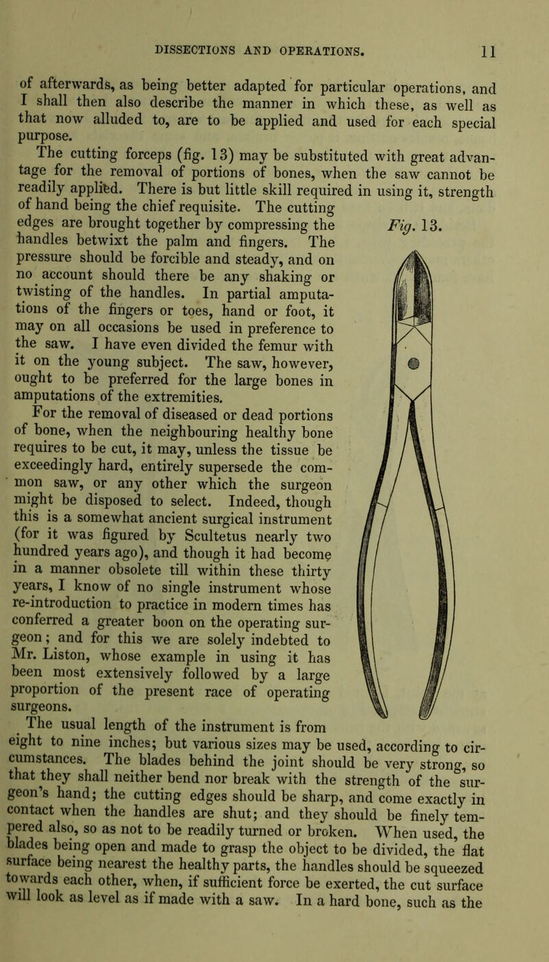 of afterwards, as being better adapted for particular operations, and I shall then also describe the manner in which these, as well as that now alluded to, are to be applied and used for each special purpose. The cutting forceps (fig. 13) may be substituted with great advan- tage for the removal of portions of bones, when the saw cannot be readily applifed. There is but little skill required in using it, strength of hand being the chief requisite. The cutting edges are brought together by compressing the Fig. 13. bandies betwixt the palm and fingers. The pressure should be forcible and steady, and on no account should there be any shaking or twisting of the handles. In partial amputa- tions of the fingers or toes, hand or foot, it may on all occasions be used in preference to the saw. I have even divided the femur with it on the young subject. The saw, however, ought to be preferred for the large bones in amputations of the extremities. For the removal of diseased or dead portions of bone, when the neighbouring healthy bone requires to be cut, it may, unless the tissue be exceedingly hard, entirely supersede the com- ’ mon saw, or any other which the surgeon might be disposed to select. Indeed, though this is a somewhat ancient surgical instrument (for it was figured by Scultetus nearly two hundred years ago), and though it had become in a manner obsolete till within these thirty years, I know of no single instrument whose re-introduction to practice in modem times has conferred a greater boon on the operating sur- geon ; and for this we are solely indebted to Mr. Liston, whose example in using it has been most extensively followed by a large proportion of the present race of operating surgeons. The usual length of the instrument is from eight to nine inches; but various sizes may be used, according to cir- cumstances. The blades behind the joint should be very strong, so that they shall neither bend nor break with the strength of the sur- geon’s hand; the cutting edges should be sharp, and come exactly in contact when the handles are shut; and they should be finely tem- pered also, so as not to be readily turned or broken. When used, the blades being open and made to grasp the object to be divided, the flat surface being nearest the healthy parts, the handles should be squeezed towards each other, when, if sufficient force be exerted, the cut surface will look as level as if made with a saw. In a hard bone, such as the