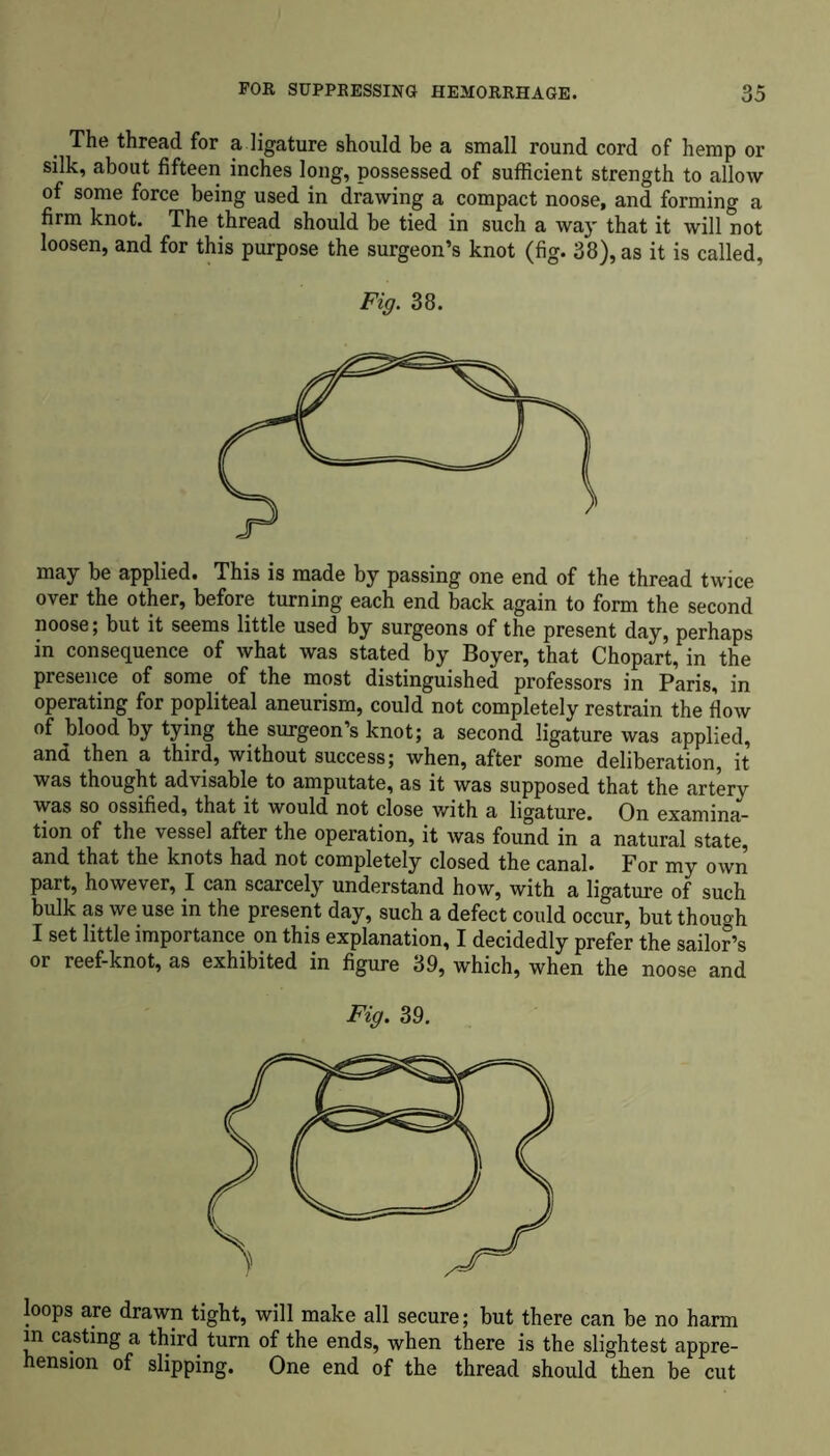 The thread for a ligature should be a small round cord of hemp or silk, about fifteen inches long, possessed of sufficient strength to allow of some force being used in drawing a compact noose, and forming a firm knot. The thread should be tied in such a way that it will not loosen, and for this purpose the surgeon’s knot (fig. 38), as it is called, Fig. 38. may be applied. This is made by passing one end of the thread twice over the other, before turning each end back again to form the second noose; but it seems little used by surgeons of the present day, perhaps in consequence of what was stated by Boyer, that Chopart, in the presence of some of the most distinguished professors in Paris, in operating for popliteal aneurism, could not completely restrain the flow of blood by tying the surgeon’s knot; a second ligature was applied, and then a third, without success; when, after some deliberation, it was thought advisable to amputate, as it was supposed that the artery was so ossified, that it would not close with a ligature. On examina- tion of the vessel after the operation, it was found in a natural state, and that the knots had not completely closed the canal. For my own part, however, I can scarcely understand how, with a ligature of such bulk as we use in the present day, such a defect could occur, but though I set little importance on this explanation, I decidedly prefer the sailor’s or reef-knot, as exhibited in figure 39, which, when the noose and Fig. 39. loops are drawn tight, will make all secure; but there can be no harm in casting a third turn of the ends, when there is the slightest appre- hension of slipping. One end of the thread should then be cut