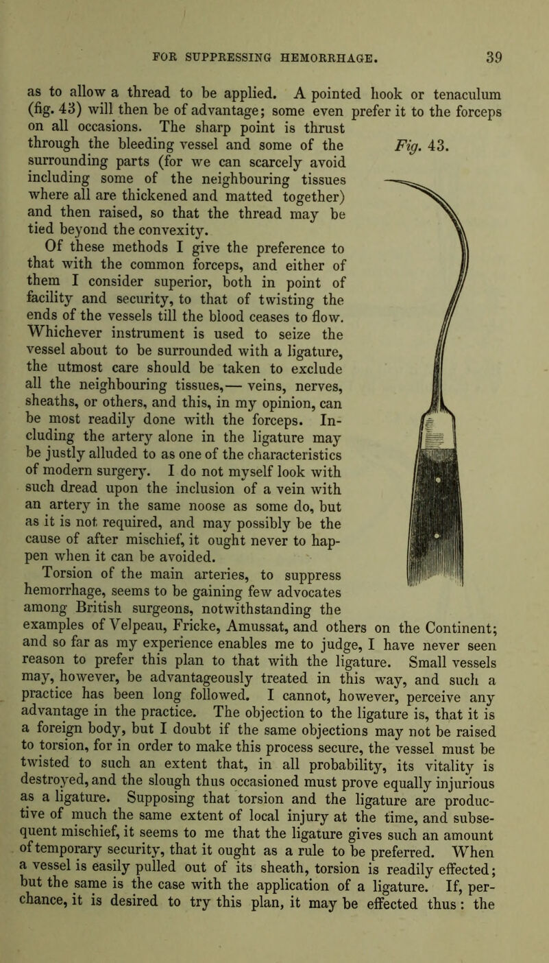 as to allow a thread to be applied. A pointed hook or tenaculum (fig. 43) will then he of advantage; some even prefer it to the forceps on all occasions. The sharp point is thrust through the bleeding vessel and some of the surrounding parts (for we can scarcely avoid including some of the neighbouring tissues where all are thickened and matted together) and then raised, so that the thread may be tied beyond the convexity. Of these methods I give the preference to that with the common forceps, and either of them I consider superior, both in point of facility and security, to that of twisting the ends of the vessels till the blood ceases to flow. Whichever instrument is used to seize the vessel about to be surrounded with a ligature, the utmost care should be taken to exclude all the neighbouring tissues,— veins, nerves, sheaths, or others, and this, in my opinion, can be most readily done with the forceps. In- cluding the artery alone in the ligature may be justly alluded to as one of the characteristics of modern surgery. I do not myself look with such dread upon the inclusion of a vein with an artery in the same noose as some do, but as it is not required, and may possibly be the cause of after mischief, it ought never to hap- pen when it can be avoided. Torsion of the main arteries, to suppress hemorrhage, seems to be gaining few advocates among British surgeons, notwithstanding the examples of Velpeau, Fricke, Amussat, and others on the Continent; and so far as my experience enables me to judge, I have never seen reason to prefer this plan to that with the ligature. Small vessels may, however, be advantageously treated in this way, and such a practice has been long followed. I cannot, however, perceive any advantage in the practice. The objection to the ligature is, that it is a foreign body, but I doubt if the same objections may not be raised to torsion, for in order to make this process secure, the vessel must be twisted to such an extent that, in all probability, its vitality is destroyed, and the slough thus occasioned must prove equally injurious as a ligature. Supposing that torsion and the ligature are produc- tive of much the same extent of local injury at the time, and subse- quent mischief, it seems to me that the ligature gives such an amount of temporary security, that it ought as a rule to be preferred. When a vessel is easily pulled out of its sheath, torsion is readily effected; but the same is the case with the application of a ligature. If, per- chance, it is desired to try this plan, it may be effected thus: the Fig. 43.