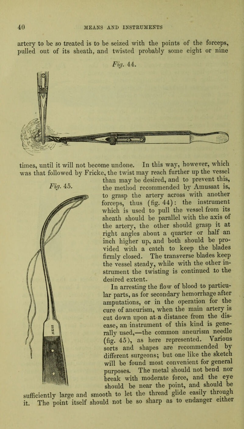 artery to be so treated is to be seized with the points of the forceps, pulled out of its sheath, and twisted probably some eight or nine Fig. 44. Fig. 45. times, until it will not become undone. In this way, however, which was that followed by Fricke, the twist may reach further up the vessel than may be desired, and to prevent this, the method recommended by Amussat is, to grasp the artery across with another forceps, thus (fig. 44): the instrument which is used to pull the vessel from its sheath should be parallel with the axis of the artery, the other should grasp it at right angles about a quarter or half an inch higher up, and both should be pro- vided with a catch to keep the blades firmly closed. The transverse blades keep the vessel steady, while with the other in- strument the twisting is continued to the desired extent. In arresting the flow of blood to particu- lar parts, as for secondary hemorrhage after amputations, or in the operation for the cure of aneurism, when the main artery.is cut down upon at-a distance from the dis- ease, an instrument of this kind is gene- rally used,—the common aneurism needle (fig. 45), as here represented. Various sorts and shapes are recommended by different surgeons; but one like the sketch will be found most convenient for general purposes. The metal should not bend nor break with moderate force, and the eye should be near the point, and should be sufficiently large and smooth to let the thread glide easily through it. The point itself should not be so sharp as to endanger either