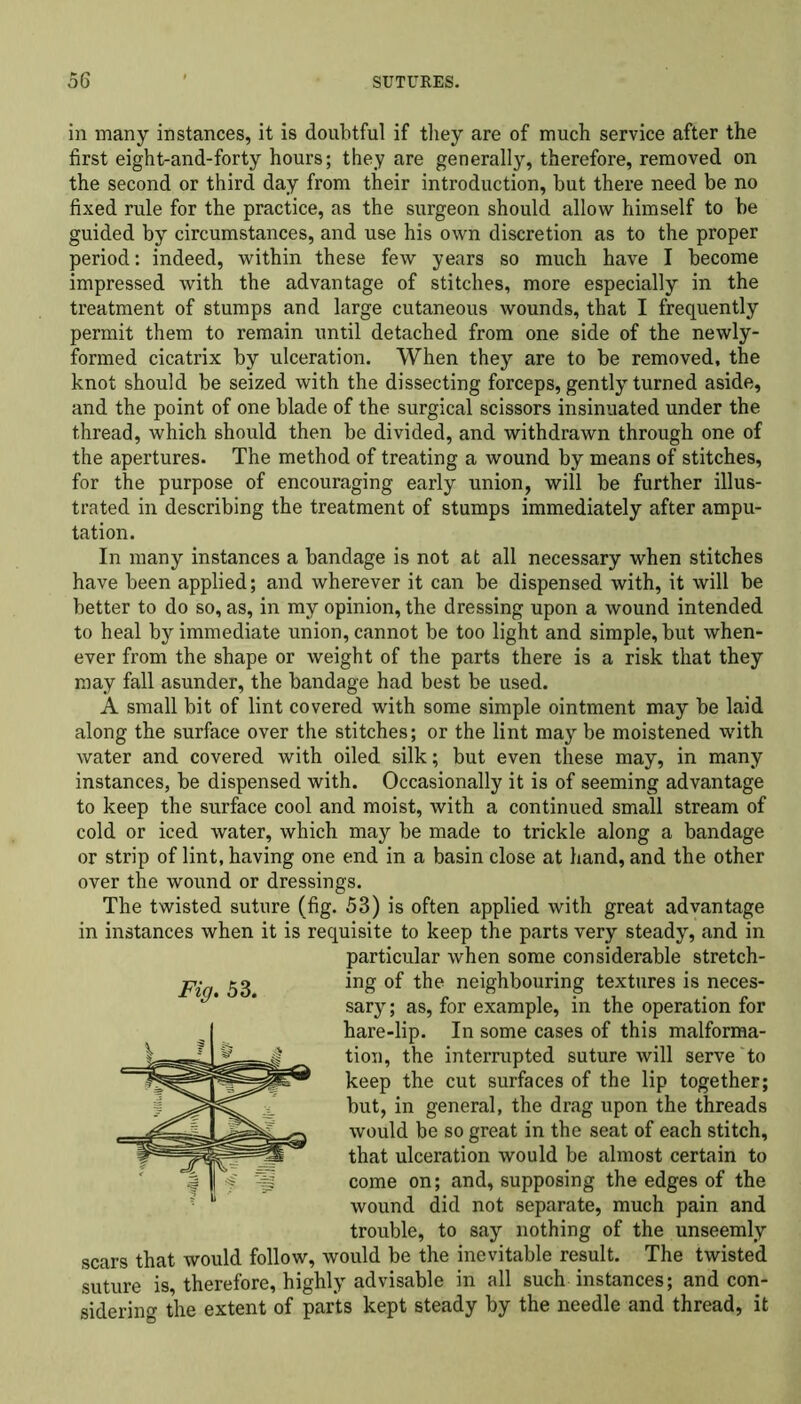 in many instances, it is doubtful if they are of much service after the first eight-and-forty hours; they are generally, therefore, removed on the second or third day from their introduction, but there need be no fixed rule for the practice, as the surgeon should allow himself to be guided by circumstances, and use his own discretion as to the proper period: indeed, within these few years so much have I become impressed with the advantage of stitches, more especially in the treatment of stumps and large cutaneous wounds, that I frequently permit them to remain until detached from one side of the newly- formed cicatrix by ulceration. When they are to be removed, the knot should be seized with the dissecting forceps, gently turned aside, and the point of one blade of the surgical scissors insinuated under the thread, which should then be divided, and withdrawn through one of the apertures. The method of treating a wound by means of stitches, for the purpose of encouraging early union, will be further illus- trated in describing the treatment of stumps immediately after ampu- tation. In many instances a bandage is not at all necessary when stitches have been applied; and wherever it can be dispensed with, it will be better to do so, as, in my opinion, the dressing upon a wound intended to heal by immediate union, cannot be too light and simple, but when- ever from the shape or weight of the parts there is a risk that they may fall asunder, the bandage had best be used. A small bit of lint covered with some simple ointment may be laid along the surface over the stitches; or the lint may be moistened with water and covered with oiled silk; but even these may, in many instances, be dispensed with. Occasionally it is of seeming advantage to keep the surface cool and moist, with a continued small stream of cold or iced water, which may be made to trickle along a bandage or strip of lint, having one end in a basin close at hand, and the other over the wound or dressings. The twisted suture (fig. 53) is often applied with great advantage in instances when it is requisite to keep the parts very steady, and in particular when some considerable stretch- ing of the neighbouring textures is neces- sary ; as, for example, in the operation for hare-lip. In some cases of this malforma- tion, the interrupted suture will serve to keep the cut surfaces of the lip together; but, in general, the drag upon the threads would be so great in the seat of each stitch, that ulceration would be almost certain to come on; and, supposing the edges of the wound did not separate, much pain and trouble, to say nothing of the unseemly scars that would follow, would be the inevitable result. The twisted suture is, therefore, highly advisable in all such instances; and con- sidering the extent of parts kept steady by the needle and thread, it