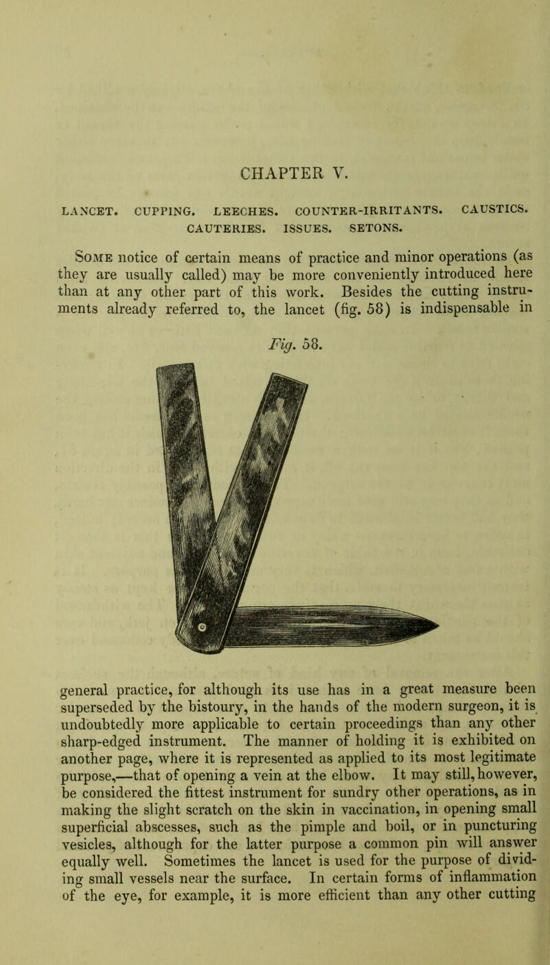 LANCET. CUPPING. LEECHES. COUNTER-IRRITANTS. CAUSTICS. CAUTERIES. ISSUES. SETONS. Some notice of certain means of practice and minor operations (as they are usually called) may be more conveniently introduced here than at any other part of this work. Besides the cutting instru- ments already referred to, the lancet (fig. 58) is indispensable in Fig. 58. general practice, for although its use has in a great measure been superseded by the bistoury, in the hands of the modern surgeon, it is undoubtedly more applicable to certain proceedings than any other sharp-edged instrument. The manner of holding it is exhibited on another page, where it is represented as applied to its most legitimate purpose,—that of opening a vein at the elbow. It may still, however, be considered the fittest instrument for sundry other operations, as in making the slight scratch on the skin in vaccination, in opening small superficial abscesses, such as the pimple and boil, or in puncturing vesicles, although for the latter purpose a common pin will answer equally well. Sometimes the lancet is used for the purpose of divid- ing small vessels near the surface. In certain forms of inflammation of the eye, for example, it is more efficient than any other cutting