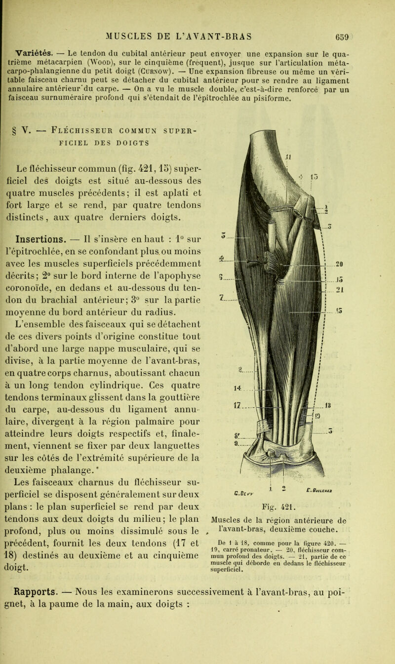 Variétés. — Le tendon du cubital antérieur peut envoyer une expansion sur le qua- trième métacarpien (Wood), sur le cinquième (fréquent), jusque sur l’articulation méta- carpo-phalangienne du petit doigt (Gurxow). — Une expansion fibreuse ou même un véri- table faisceau charnu peut se détacher du cubital antérieur pour se rendre au ligament annulaire antérieur'du carpe. — On a vu le muscle double, c’est-à-dire renforcé par un faisceau surnuméraire profond qui s’étendait de l’épitrochlée au pisiforme. § V. — Fléchisseur commun super- ficiel DES doigts Le fléchisseur commun (fîg. 421, lo) super- ficiel des doigts est situé au-dessous des quatre muscles précédents; il est aplati et fort large et se rend, par quatre tendons distincts, aux quatre derniers doigts. Insertions. — Il s’insère en haut : 1° sur l’épitrochlée, en se confondant plus, ou moins avec les muscles superficiels précédemment décrits ; 2° sur le bord interne de l’apophyse coronoïde, en dedans et au-dessous du ten- don du brachial antérieur; 3° sur la partie moyenne du bord antérieur du radius. L’ensemble des faisceaux qui se détachent de ces divers points d’origine constitue tout d’abord une large nappe musculaire, qui se divise, à la partie moyenne de l’avant-bras, en quatre corps charnus, aboutissant chacun à un long tendon cylindrique. Ces quatre tendons terminaux glissent dans la gouttière du carpe, au-dessous du ligament annu- laire, divergent à la région palmaire pour atteindre leurs doigts respectifs et, finale- ment, viennent se fixer par deux languettes sur les côtés de l’extrémité supérieure de la deuxième phalange.* Les faisceaux charnus du fléchisseur su- perficiel se disposent généralement sur deux plans : le plan superficiel se rend par deux tendons aux deux doigts du milieu ; le plan profond, plus ou moins dissimulé sous le , précédent, fournit les deux tendons (17 et 18) destinés au deuxième et au cinquième doigt. Fig. 421. Muscles de la région antérieure de l’avant-bras, deuxième couche. De 1 à 18, comme pour la figure 420. — 19, carré pronateur. — 20, fléchisseur com- mun profond des doigts. — 21, partie de ce muscle qui déborde en dedans le fléchisseur superficiel. Rapports. — Nous les examinerons successivement à l’avant-bras, au poi- gnet, à la paume de la main, aux doigts :