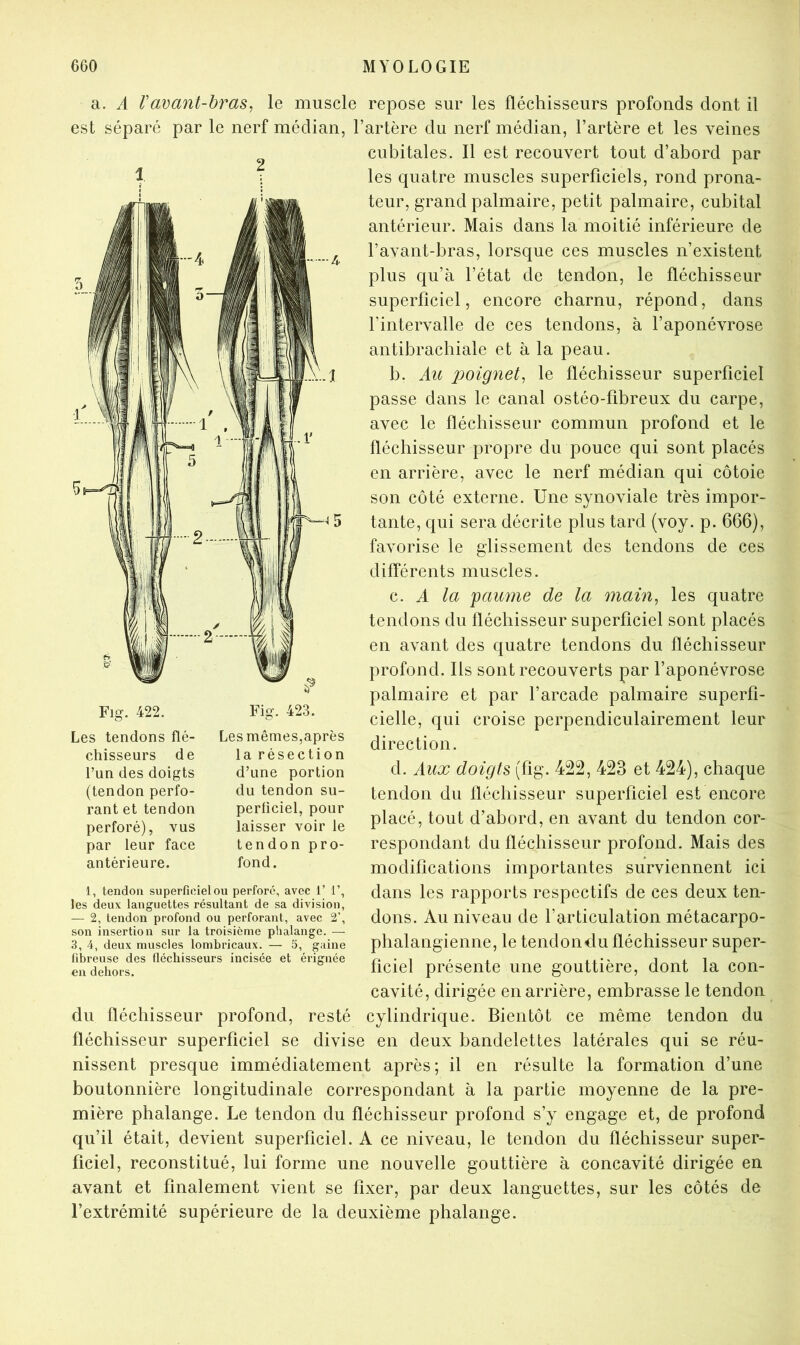 a. A Vavant-bras, le muscle repose sur les fléchisseurs profonds dont il est séparé par le nerf médian, l’artère du nerf médian, l’artère et les veines ^ cubitales. Il est recouvert tout d’abord par 1 ; les quatre muscles superficiels, rond prona- teur, grand palmaire, petit palmaire, cubital antérieur. Mais dans la moitié inférieure de l’avant-bras, lorsque ces muscles n’existent plus qu’à l’état de tendon, le fléchisseur superficiel, encore charnu, répond, dans l’intervalle de ces tendons, à l’aponévrose antibrachiale et à la peau. b. Au poignet, le fléchisseur superficiel passe dans le canal ostéo-fibreux du carpe, avec le fléchisseur commun profond et le fléchisseur propre du pouce qui sont placés en arrière, avec le nerf médian qui côtoie son côté externe. Une synoviale très impor- tante, qui sera décrite plus tard (voy. p. 666), favorise le glissement des tendons de ces différents muscles. c. A la jaunie de la main, les quatre tendons du fléchisseur superficiel sont placés en avant des quatre tendons du fléchisseur profond. Ils sont recouverts par l’aponévrose palmaire et par l’arcade palmaire superfi- cielle, qui croise perpendiculairement leur direction. d. Aux doigts (fig. 422, 423 et 424), chaque tendon du fléchisseur superficiel est encore placé, tout d’abord, en avant du tendon cor- respondant du fléchisseur profond. Mais des modifications importantes surviennent ici dans les rapports respectifs de ces deux ten- dons. Au niveau de l’articulation métacarpo- phalangienne, le tendon du fléchisseur super- ficiel présente une gouttière, dont la con- cavité, dirigée en arrière, embrasse le tendon du fléchisseur profond, resté cylindrique. Bientôt ce même tendon du fléchisseur superficiel se divise en deux bandelettes latérales qui se réu- nissent presque immédiatement après; il en résulte la formation d’une boutonnière longitudinale correspondant à la partie moyenne de la pre- mière phalange. Le tendon du fléchisseur profond s’y engage et, de profond qu’il était, devient superficiel. A ce niveau, le tendon du fléchisseur super- ficiel, reconstitué, lui forme une nouvelle gouttière à concavité dirigée en avant et finalement vient se fixer, par deux languettes, sur les côtés de l’extrémité supérieure de la deuxième phalange. Les tendons flé- chisseurs de l’un des doigts (tendon perfo- rant et tendon perforé), vus par leur face antérieure. Fig. 423. Les mêmes,après la résection d’une portion du tendon su- perficiel, pour laisser voir le tendon pro- fond. 1, tendon superficiel ou perfore, avec 1’ 1’, les deux languettes résultant de sa division, — 2, tendon profond ou perforant, avec 2’, son insertion sur la troisième plialange. — 3, 4, deux muscles lombricaux. — 5, gaine fibreuse des lléchisseurs incisée et érignée en dehors.