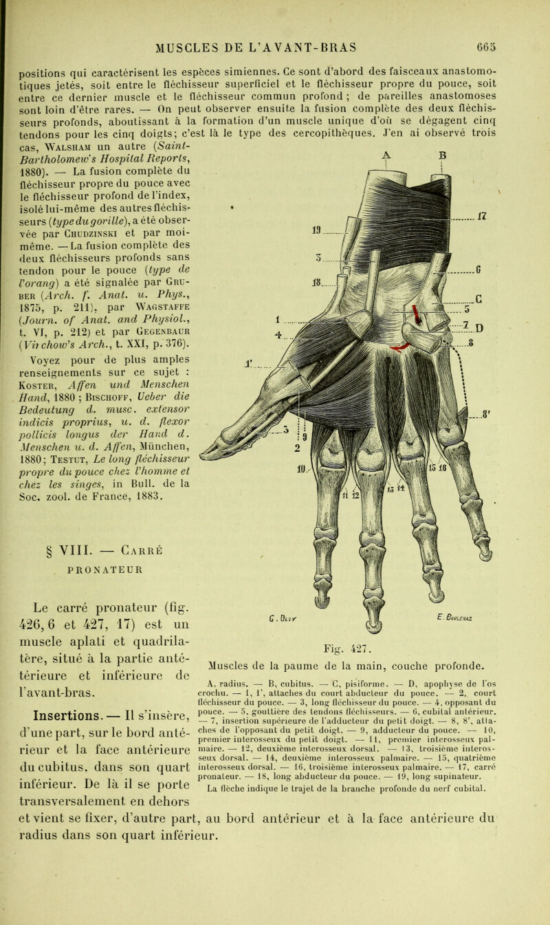 positions qui caractérisent les espèces simiennes. Ce sont d’abord des faisceaux anastomo- tiques jetés, soit entre le fléchisseur superficiel et le fléchisseur propre du pouce, soit entre ce dernier muscle et le fléchisseur commun profond ; de pareilles anastomoses sont loin d’être rares. — On peut observer ensuite la fusion complète des deux fléchis- seurs profonds, aboutissant à la formation d’un muscle unique d’où se dégagent cinq tendons pour les cinq doigts; c’est là le type des cercopithèques. J’en ai observé trois cas, Walsham un autre {Saint- Bar tholomeic' s Hospital Reports^ 1380). — La fusion complète du fléchisseur propre du pouce avec le fléchisseur profond de l’index, isolé lui-même des autres fléchis- seurs {type du gorille), a été obser- vée par Chüdzinski et par moi- même. — La fusion complète des deux fléchisseurs profonds sans tendon pour le pouce {type de Vorang) a été signalée par Grü- BER {Arch. f. Anat. u. Phys., 1875, p. 211), par Wagstaffe {Journ. of Anat. and Physiol., t. VJ, p. 212) et par Gegenbaur {Virchow's Arch., t. XXI, p. 376). Voyez pour de plus amples renseignements sur ce sujet : Koster, Affen und Menschen Hand, 1880 ; Bischoff, Ueber die Bedeutung d. musc, extensor indicis proprius, u. d. ftexor pollicis longus der Hand d. Menschen u. d. Affen, München, 1880; Testut, Le long fléchisseur propre du pouce chez Vhomme et chez les singes, in Bull, de la Soc. zool. de France, 1883. § VIII. — Carré PRONATEUR Le carré proiiateur (fîg. 426,6 et 427, 17) est un muscle aplati et quadrila- tère, situé à la partie anté- térieure et inférieure de l’avant-bras. Insertions. — Il s’insère, d’une part, sur le bord anté- rieur et la face antérieure du cubitus, dans son quart inférieur. De là il se porte Muscles de la paume de la main, couche profonde. A. radius. — B, cubitus. — C, pisiforme. — D, apophyse de l’os crochu. — 1, 1’, attaches du court abducteur du pouce. —■ 2, court fléchisseur du pouce. — 3, long fléchisseur du pouce. — 4, opposant du pouce. — 3, gouttière des tendons flédiisseurs. — G, cubital antérieur. — 7, insertion supérieure de l'adducteur du petit doigt. — 8, 8’, atla- ches de l’opposant du petit doigt. — 9, adducteur du pouce. — 10, premier interosseux du petit doigt. — 11, premier interosseux pal- maire. — 12, deuxième interosseux dorsal. — 13, troisième interos- seux dorsal. — 14, deuxième interosseux palmaire. — 13, quatrième interosseux dorsal. — 16, troisième interosseux palmaire. ■— 17, carré pronateur. •— 18, long abducteur du pouce. — 19, long supinateur. La flèche indique le trajet de la branche profonde du nerf cubital. \ transversalement en dehors et vient se fixer, d’autre part, au bord antérieur et à la face antérieure du radius dans son quart inférieur.