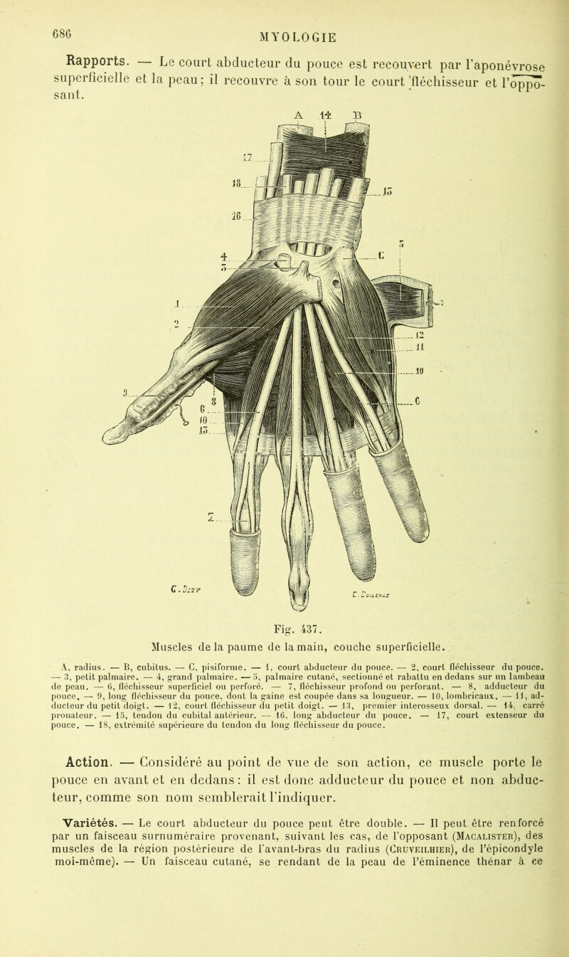 68G Rapports. — Le court abducteur du pouce est recouvert par l’aponévrose superficielle et la peau ; il recouvre à son tour le court fléchisseur et l’oppo- sant. Fig. 437. Muscles delà paume de la main, couche superficielle. A, radius. — B, cubitus. — G, pisiforme. — 1, court abducteur du pouce. — 2, court fléchisseur du pouce. — 3, petit palmaire. — 4, grand palmaire. — 5, palmaire cutané, sectionné et rabattu en dedans sur un lambeau de peau. — 6, fléchisseur superficiel ou perforé. — 7, fléchisseur profond ou perforant. — 8, adducteur du pouce. — 9, long fléchisseur du pouce, dont la gaine est coupée dans sa longueur. — 10, lombricaux. — H, ad- ducteur du petit doigt. — 12, court fléchisseur du petit doigt. — 13, premier interosseux dorsal. — 14, carré pronateur. — 15, tendon du cubital antérieur. — 16. long abducteur du pouce. — 17, court extenseur du pouce. — 18, extrémité supérieure du tendon du long fléchisseur du pouce. Action. — Considéré au point de vue de son action, ce muscle porte le pouce en avant et en dedans: il est donc adducteur du pouce et non abduc- teur, comme son nom semblerait l’indiquer. Variétés. — Le court abducteur du pouce peut être double. — Il peut être renforcé par un faisceau surnuméraire provenant, suivant les cas, de l’opposant (Macalister), des muscles de la région postérieure de l’avant-bras du radius (Cruveilhier), de l’épicondyle moi-même). — Un faisceau cutané, se rendant de la peau de l’éminence thénar à ce