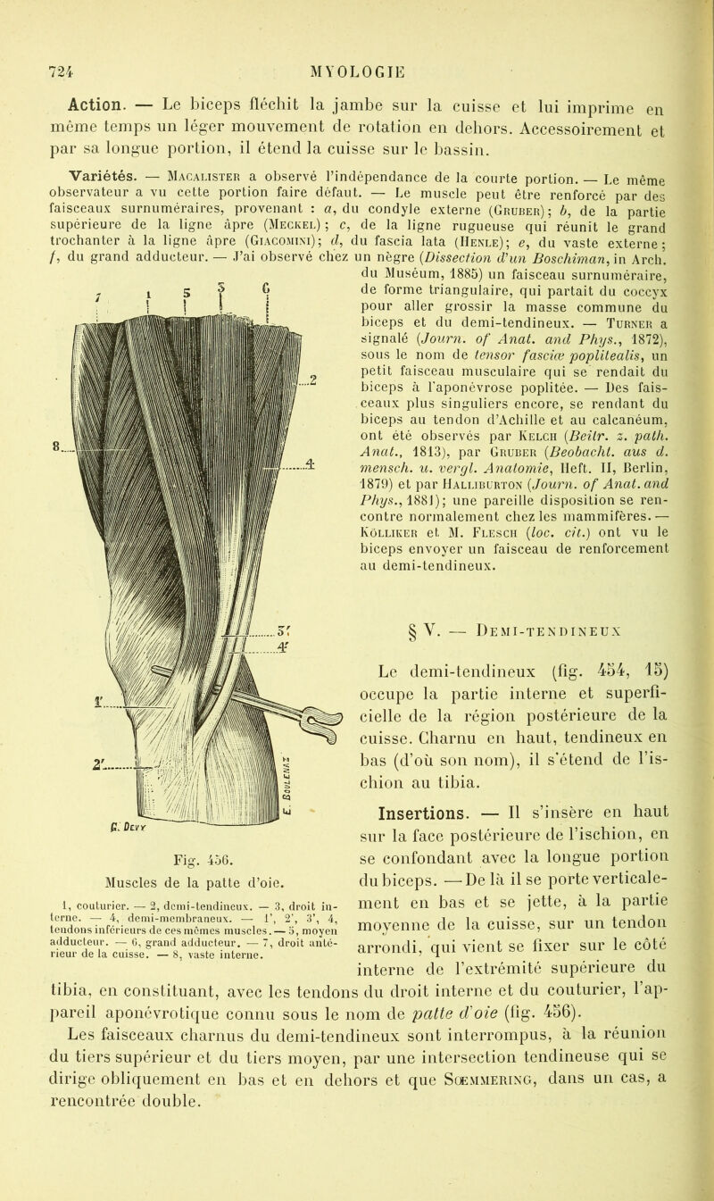 Action. — Le biceps fléchit la jambe sur la cuisse et lui imprime en même temps un léger mouvement de rotation en dehors. Accessoirement et par sa longue portion, il étend la cuisse sur le bassin. Variétés. — Macalister a observé l’indépendance de la courte portion. Le même observateur a vu cette portion faire défaut. — Le muscle peut être renforcé par des faisceaux surnuméraires, provenant : a, du condyle externe (Gruber) ; 6, de la partie supérieure de la ligne âpre (Meckel) ; c, de la ligne rugueuse qui réunit le grand trochanter à la ligne âpre (Giacomini); d, du fascia lata (Henle); e, du vaste externe; /, du grand adducteur. — J’ai observé chez un nègre {Dissection d'un Boschiman.m Arch’. du Muséum, 1885) un faisceau surnuméraire, de forme triangulaire, qui partait du coccyx pour aller grossir la masse commune du biceps et du demi-tendineux. — Turner a signalé {Journ. of Anat. and Phys.^ 1872), sous le nom de tensor fasciœ poplitealis, un petit faisceau musculaire qui se rendait du biceps (à l'aponévrose poplitée. — Des fais- ceaux plus singuliers encore, se rendant du biceps au tendon d’Achille et au calcanéum, ont été observés par Kelch [Beilr. z. path. Anal., 1813), par Gruber {Beobacht. ans d. mensch. u. vergl. Anatomie, Heft. II, Berlin, 1879) et par Halliburton {Journ. of Anat. and P/i?/s., 1881) ; une pareille disposition se ren- contre normalement chez les mammifères.— Kôlliker et M. Flesch {loc. cit.) ont vu le biceps envoyer un faisceau de renforcement au demi-tendineux. § V. — Demi-tendineux Le demi-tendineux (fig. 454, 15) occupe la partie interne et superfi- cielle de la région postérieure de la cuisse. Charnu en haut, tendineux en bas (d’où son nom), il s'étend de l’is- chion au tibia. Insertions. — Il s’insère en haut sur la face postérieure de l’ischion, en Fig. 456. se confondant avec la longue portion Muscles de la patte d’oie. du biceps. —Delà il se porte verticale- 1, couturier. — 2, demi-tendineux. — 3, droit in- meilt eil baS et Se jette, à la pai lie moyenne de la cuisse, sur un tendon HettTa arrondi, qui vient se fixer sur le côté interne de l’extrémité supérieure du tibia, en constituant, avec les tendons du droit interne et du couturier, l’ap- pareil aponévrotique connu sous le nom de patte (Toie (fig. 456). Les faisceaux charnus du demi-tendineux sont interrompus, à la réunion du tiers supérieur et du tiers moyen, par une intersection tendineuse qui se dirige obliquement en bas et en dehors et que Sœmmering, dans un cas, a rencontrée double.