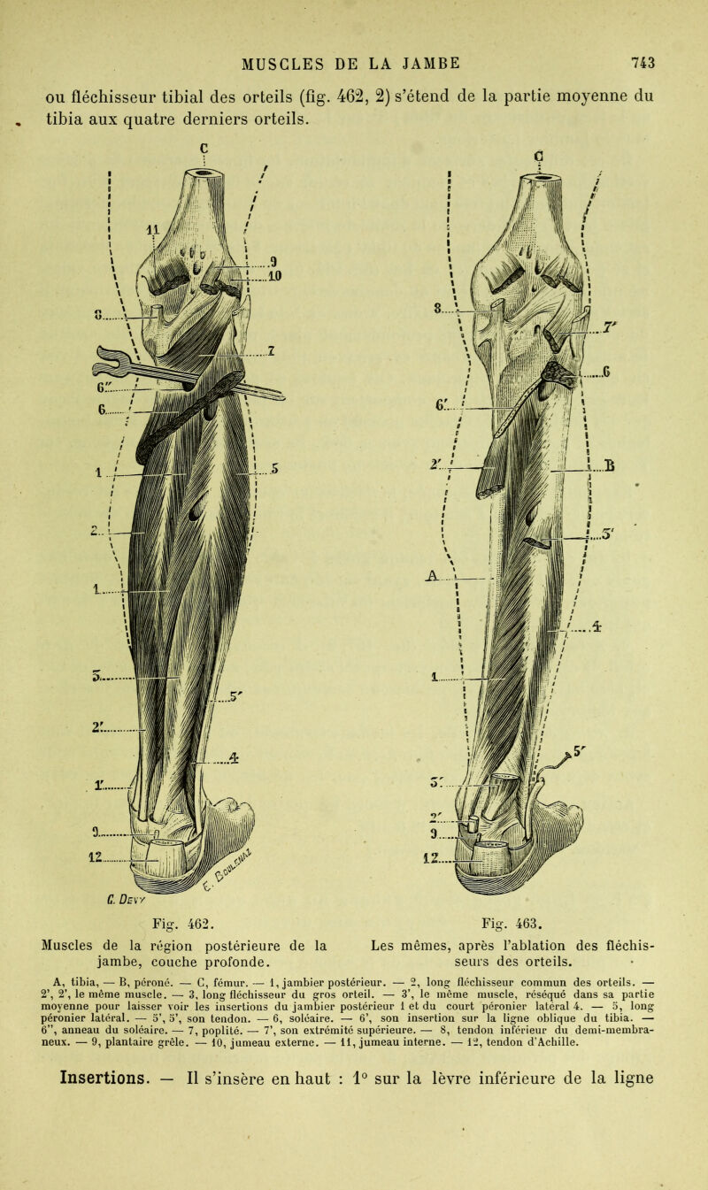 ou fléchisseur tibial des orteils (fîg. 462, 2) s’étend de la partie moyenne du tibia aux quatre derniers orteils. Fig. 462. Fig. 463. Muscles de la région postérieure de la Les mêmes, après l’ablation des fléchis- jambe, couche profonde. seins des orteils. A, tibia, — B, péroné. — G, fémur. — 1, jambier postérieur. — 2, long fléchisseur commun des orteils. — 2’, 2’, le même muscle. — 3, long fléchisseur du gros orteil. — 3’, le même muscle, réséqué dans sa partie moyenne pour laisser voir les insertions du jambier postérieur 1 et du court péronier latéral 4. — 5, long péronier latéral. — 5’, 5’, son tendon. — 6, soléaire. — 6’, son insertion sur la ligne oblique du tibia. — 6”, anneau du soléaire. — 7, poplité. — 7’, son extrémité supérieure. — 8, tendon inférieur du demi-membra- neux. — 9, plantaire grêle. — 10, jumeau externe. — 11, jumeau interne. — 12, tendon d’Achille. Insertions. — Il s’insère en haut : 1° sur la lèvre inférieure de la ligne