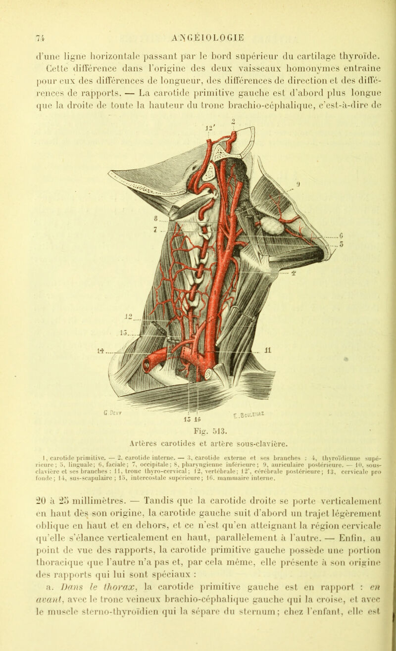 A>j'GE10L0GIE (Time ligne horizontale passant par le bord supérieur du cartilage thyroïde. Cette différence dans l’origine des deux vaisseaux homonymes entraîne pour eux des différences de longueur, des différences de direction et des diffé- rences de rapports. — La carotide primitive gauche est d’abord i)lus longue (pie la droite de toute la hauteur du tronc brachio-céphaliijue, c’est-à-dire de Fig. 513. Artères carotides et artère sous-clavière. I, carotkle primitive. — 2, carotide interne. — 3, carotide externe et ses brandies : 4, thyroïtiienne supé- rieure; O, linguale; 0, faciale; 7, occipitale; 8, pharyngienne inférieure; 9, auriculaire postérieure. — 10, sous- clavière et ses branches ; 11, tronc lliyro-cervical ; 12, vertébrale; 12’, cérébrale postérieure; 13, cervicale pro fonde; 14, sus-scapulaire; 15, intercostale supérieure; IC. mammaire interne. :20 à :2o millimètres. — Tandis que la carotide droite se porte verticalement en haut dès son origine, la carotide gauche suit d’abord un trajet légèrement olilique en haut et en dehors, et ce n’est qu’en atteignant la région cervicale ([u’elle s’élance verticalement en haut, parallèlement à l’autre. — Enlin, au point de vue des rapports, la carotide primitive gauche possède une porlion thoracique ({ue l’autre n’a pas et, par cela môme, elle présente à son origine des rapports qui lui sont spéciaux : a. Dans le thorax^ la carotide primitive gauche est en rajiport : en avant, avec le tronc veineux brachio-céphalique gauche fjui la croise, et avec le muscle sterno-thyroïdien qui la sépare du sternum; chez l’enl'ant, elle est