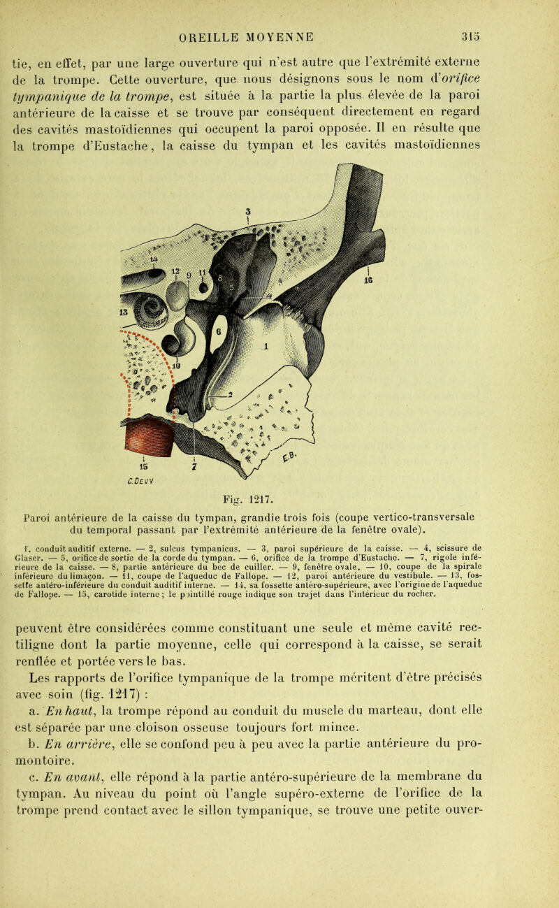 tie, en effet, par une large ouverture qui n’est autre que l’extrémité externe de la trompe. Cette ouverture, que nous désignons sous le nom Ôl orifice tympanique de la trompe^ est située à la partie la plus élevée de la paroi antérieure de la caisse et se trouve par conséquent directement en regard des cavités mastoïdiennes qui occupent la paroi opposée. Il en résulte que la trompe d’Eustache, la caisse du tympan et les cavités mastoïdiennes Fig. 1217. Paroi antérieure de la caisse du tympan, grandie trois fois (confie vertico-transversale du temporal passant par l’extrémité antérieure de la fenêtre ovale). i, conduit auditif externe, — 2, sulcus tympanicus. — 3, paroi supérieure de la caisse. — 4, scissure de Glaser. — 5, orifice de sortie de la corde du tympan. — 6, orifice de la trompe d’Eustache. — 7, rigole infé- rieure de la caisse. — 8, partie antérieure du bec de cuiller. — 9, fenêtre ovale. — 10, coupe de la spirale inférieure du limaçon. — 11, coupe de l’aqueduc de Fallope. — 12, paroi antérieure du vestibule. — 13, fos- sette antéro-inférieure du conduit auditif interne. — 14, sa fossette antéro-supérieure, avec l’origine de l’aqueduc de Fallope. — 15, carotide interne; le pointillé rouge indique son trajet dans l’intérieur du rocher. peuvent être considérées comme constituant une seule et même cavité rec- tiligne dont la partie moyenne, celle qui correspond à la caisse, se serait renflée et portée vers le bas. Les rapports de l’orifice tympanique de la trompe méritent d’être précisés avec soin (fîg. 1217) : di. En haut, la trompe répond au conduit du muscle du marteau, dont elle est séparée par une cloison osseuse toujours fort mince. b. En arrière, elle se confond peu à peu avec la partie antérieure du pro- montoire. c. En avant, elle répond à la partie antéro-supérieure de la membrane du tympan. Au niveau du point où l’angle supéro-externe de l’orifice de la trompe prend contact avec le sillon tympanique, se trouve une petite ouver-