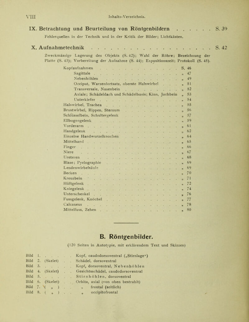 IX. Betrachtung und Beurteilung von Röntgenbildern . . . . Fehlerquellen in der Technik und in der Kritik der Bilder; Lichtkästen. X. Aufnahmetechnik Zweckmässige Lagerung des Objekts (S. 42); Wahl der Röhre; Bezeichnung der Platte (S. 43); Vorbereitung der Aufnahme (S. 44); Expositionszeit; Protokoll (S. 45). Kopfaufnahmen Sagittale Nebenhöhlen Occiput, Warzenfortsatz, oberste Halswirbel Transversale, Nasenbein Axiale; Schädeldach und Schädelbasis; Kinn, Jochbein Unterkiefer Halswirbel, Trachea Brustwirbel, Rippen, Sternum Schlüsselbein, Schultergelenk Ellbogengelenk Vorderarm Handgelenk Einzelne Handwurzelknochen Mittelhand Finger Niere Ureteren Blase; Pyelographie Lendenwirbelsäule Becken Kreuzbein Hüftgelenk Kniegelenk Unterschenkel Fussgelenk, Knöchel Calcaneus Mittelfuss, Zehen S. 46 n 47 • 49 • 51 „ 52 • 53 V 54 „ 55 » 56 . 57 „ 59 • 61 „ 62 „ 64 » 65 * 66 v 67 * 68 » 69 . 69 . 70 » 71 „ 72 » 74 » 76 . 77 n 78 B. Röntgenbilder. (120 Seiten in Autotypie, mit erklärendem Text und Skizzen) Bild 1. . . . Bild 2. (Skelet) Bild 3. . . . Bild 4. (Skelet) Bild 5. . . . Bild 6. (Skelet) Bild 7- X jj ) Bild 8. ( „ ) Kopf, caudodorsoventral („Stirnlage“) Schädel, dorsoventral Kopf, dorsoventral, Nebenhöhlen Gesichtsschädel, caudodorsoventral Stirnhöhlen, dorsoventral Orbita, axial (von oben bestrahlt) „ frontal (seitlich) „ occipitofrontal S. 39 42