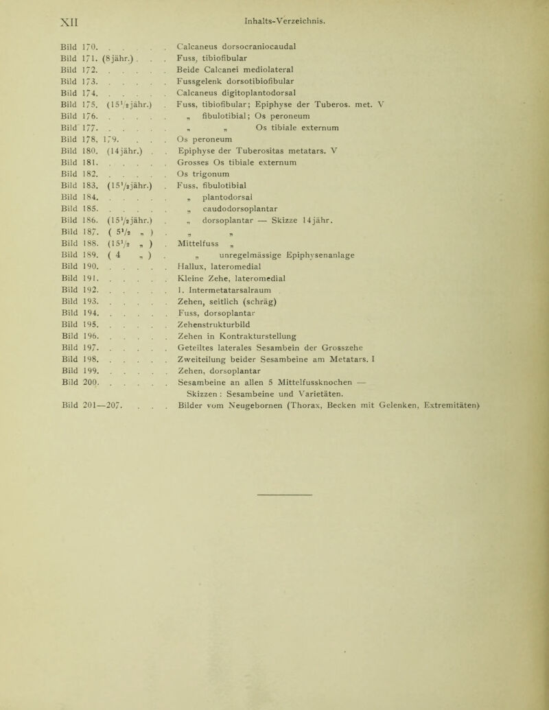 Bild i;o. Calcaneus dorsocraniocaudal Bild 171. (8jähr.) . Fuss, tibiofibular Bild 172. Beide Calcanei mediolateral Bild 173. Fussgelenk dorsotibiofibular Bild 174. Calcaneus digitoplantodorsal Bild 175. (157*jähr.) Fuss, tibiofibular; Epiphyse der Tuberos. met. V Bild 176. „ fibulotibial; Os peroneum Bild 177. „ „Os tibiale externum Bild 178, 179. . . Os peroneum Bild 180. (14jähr.) Epiphyse der Tuberositas metatars. V Bild 181. Grosses Os tibiale externum Bild 182. Os trigonum Bild 183. (15'/jjähr.) Fuss, fibulotibial Bild 184. „ plantodorsal Bild 185. „ caudodorsoplantar Bild 186. (lS’/sjähr.) „ dorsoplantar — Skizze 14jähr. Bild 187. ( 5*/2 „ ) • v r> Bild 188. (157* * ) Mittelfuss „ Bild 189. (4 „ ) „ unregelmässige Epiphvsenanlage Bild 190. Hallux, lateromedial Bild 191. Kleine Zehe, lateromedial Bild 192. 1. Intermetatarsalraum Bild 193. Zehen, seitlich (schräg) Bild 194. Fuss, dorsoplantar Bild 195. Zehenstrukturbild Bild 196. Zehen in Kontrakturstellung Bild 197. Geteiltes laterales Sesambein der Grosszehe Bild 198. Zweiteilung beider Sesambeine am Metatars. 1 Bild 199. Zehen, dorsoplantar Bild 200. Sesambeine an allen 5 Mittelfussknochen — Skizzen : Sesambeine und Varietäten.