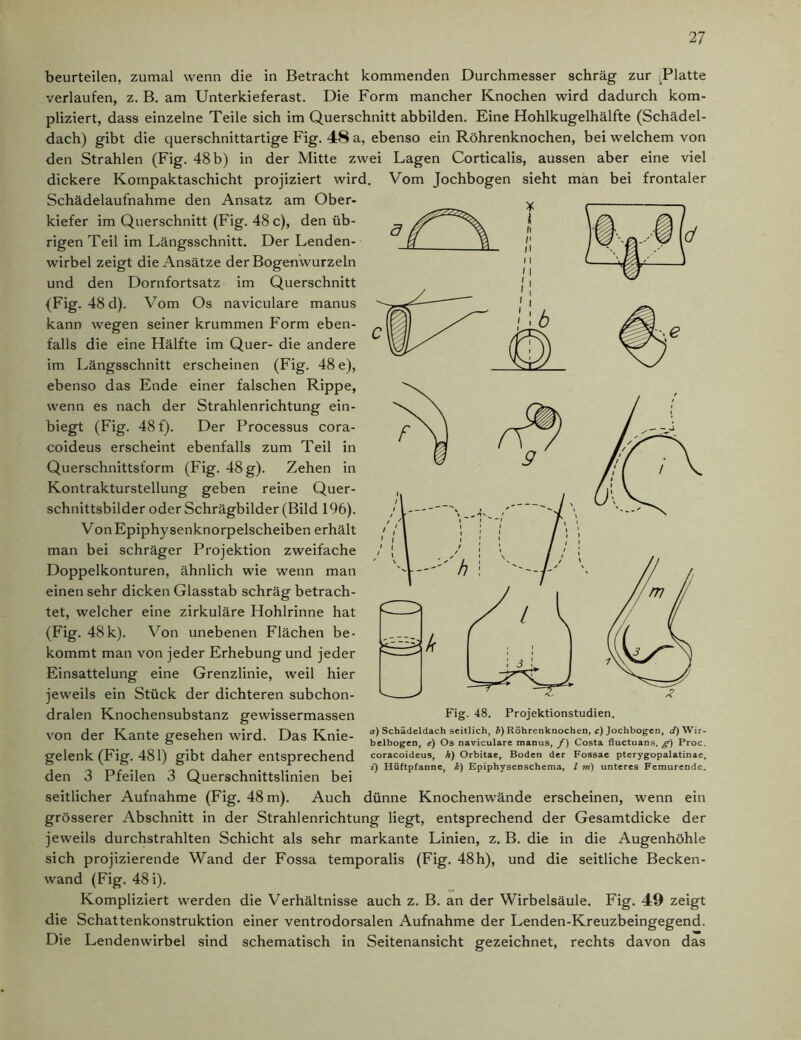 beurteilen, zumal wenn die in Betracht kommenden Durchmesser schräg zur ^Platte verlaufen, z. B. am Unterkieferast. Die Form mancher Knochen wird dadurch kom- pliziert, dass einzelne Teile sich im Querschnitt abbilden. Eine Hohlkugelhälfte (Schädel- dach) gibt die querschnittartige Fig. 48 a, ebenso ein Röhrenknochen, bei welchem von den Strahlen (Fig. 48 b) in der Mitte zwei Lagen Corticalis, aussen aber eine viel dickere Kompaktaschicht projiziert wird. Vom Jochbogen sieht man bei frontaler Schädelaufnahme den Ansatz am Ober- kiefer im Querschnitt (Fig. 48 c), den üb- rigen Teil im Längsschnitt. Der Lenden- wirbel zeigt die Ansätze der Bogenwurzeln und den Dornfortsatz im Querschnitt (Fig. 48 d). Vom Os naviculare manus kann wegen seiner krummen Form eben- falls die eine Hälfte im Quer- die andere im Längsschnitt erscheinen (Fig. 48 e), ebenso das Ende einer falschen Rippe, wenn es nach der Strahlenrichtung ein- biegt (Fig. 48 f). Der Processus cora- coideus erscheint ebenfalls zum Teil in Querschnittsform (Fig. 48 g). Zehen in Kontrakturstellung geben reine Quer- schnittsbilder oder Schrägbilder (Bild 196). Von Epiphysenknorpelscheiben erhält man bei schräger Projektion zweifache Doppelkonturen, ähnlich wie wenn man einen sehr dicken Glasstab schräg betrach- tet, welcher eine zirkuläre Hohlrinne hat (Fig. 48k). Von unebenen Flächen be- kommt man von jeder Erhebung und jeder Einsattelung eine Grenzlinie, weil hier jeweils ein Stück der dichteren subchon- dralen Knochensubstanz gewissermassen von der Kante gesehen wird. Das Knie- gelenk (Fig. 481) gibt daher entsprechend den 3 Pfeilen 3 Querschnittslinien bei seitlicher Aufnahme (Fig. 48 m). Auch dünne Knochenwände erscheinen, wenn ein grösserer Abschnitt in der Strahlenrichtung liegt, entsprechend der Gesamtdicke der jeweils durchstrahlten Schicht als sehr markante Linien, z. B. die in die Augenhöhle sich projizierende Wand der Fossa temporalis (Fig. 48h), und die seitliche Becken- wand (Fig. 48 i). Kompliziert werden die Verhältnisse auch z. B. an der Wirbelsäule. Fig. 49 zeigt die Schattenkonstruktion einer ventrodorsalen Aufnahme der Lenden-Kreuzbeingegend. Die Lendenwirbel sind schematisch in Seitenansicht gezeichnet, rechts davon das a) Schädeldach seitlich, b) Röhrenknochen, c) Jochbogen, t/) Wir- belbogen, e) Os naviculare manus, f) Costa fluctuans. g) Proc. coracoideus, h) Orbitae, Boden der Fossae pterygopalatinae, i) Hüftpfanne, k) Epiphysenschema, / nt) unteres Femurende.