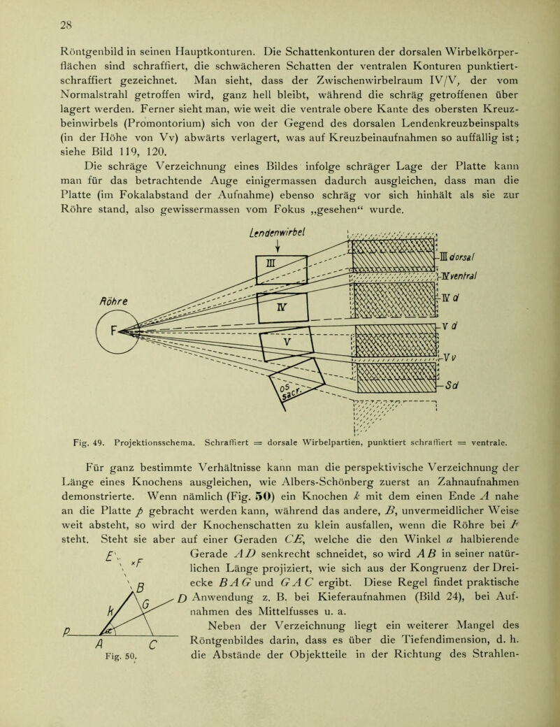 Röntgenbild in seinen Hauptkonturen. Die Schattenkonturen der dorsalen Wirbelkörper- flächen sind schraffiert, die schwächeren Schatten der ventralen Konturen punktiert- schraffiert gezeichnet. Man sieht, dass der Zwischenwirbelraum IV/V, der vom Normalstrahl getroffen wird, ganz hell bleibt, während die schräg getroffenen über lagert werden. Ferner sieht man, wie weit die ventrale obere Kante des obersten Kreuz- beinwirbels (Promontorium) sich von der Gegend des dorsalen Lendenkreuzbeinspalts (in der Höhe von Vv) abwärts verlagert, was auf Kreuzbeinaufnahmen so auffällig ist; siehe Bild 119, 120. Die schräge Verzeichnung eines Bildes infolge schräger Lage der Platte kann man für das betrachtende Auge einigermassen dadurch ausgleichen, dass man die Platte (im Fokalabstand der Aufnahme) ebenso schräg vor sich hinhält als sie zur Röhre stand, also gewissermassen vom Fokus „gesehen“ wurde. Für ganz bestimmte Verhältnisse kann man die perspektivische Verzeichnung der Länge eines Knochens ausgleichen, wie Albers-Schönberg zuerst an Zahnaufnahmen demonstrierte. Wenn nämlich (Fig. 50) ein Knochen k mit dem einen Ende A nahe an die Platte p gebracht werden kann, während das andere, B, unvermeidlicher Weise weit absteht, so wird der Knochenschatten zu klein ausfallen, wenn die Röhre bei A steht. Steht sie aber auf einer Geraden CB, welche die den Winkel a halbierende £\. *F Fig. 50. Gerade AD senkrecht schneidet, so wird AB in seiner natür- lichen Länge projiziert, wie sich aus der Kongruenz der Drei- ecke BAG und GAC ergibt. Diese Regel findet praktische O Anwendung z. B. bei Kieferaufnahmen (Bild 24), bei Auf- nahmen des Mittelfusses u. a. Neben der Verzeichnung liegt ein weiterer Mangel des Röntgenbildes darin, dass es über die Tiefendimension, d. h. die Abstände der Objektteile in der Richtung des Strahlen-