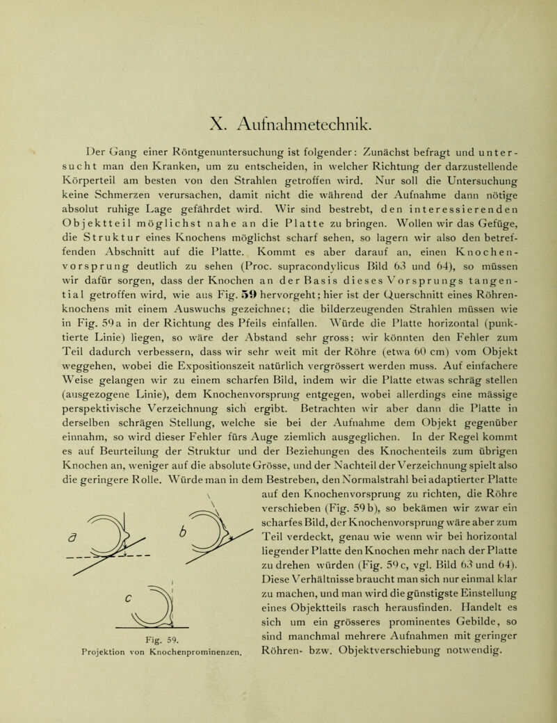 X. Auinahmetechnik. Der Gang einer Röntgenuntersuchung ist folgender: Zunächst befragt und unter- sucht man den Kranken, um zu entscheiden, in welcher Richtung der darzustellende Körperteil am besten von den Strahlen getroffen wird. Nur soll die Untersuchung keine Schmerzen verursachen, damit nicht die während der Aufnahme dann nötige absolut ruhige Lage gefährdet wird. Wir sind bestrebt, den interessierenden Objektteil möglichst nahe an die Platte zu bringen. Wollen wir das Gefüge, die Struktur eines Knochens möglichst scharf sehen, so lagern wir also den betref- fenden Abschnitt auf die Platte. Kommt es aber darauf an, einen Knochen- vorsprung deutlich zu sehen (Proc. supracondvlicus Bild 63 und 64), so müssen wir dafür sorgen, dass der Knochen an der Basis dieses Vorsprungs tangen- tial getroffen wird, wie aus Fig. 59 hervorgeht; hier ist der Querschnitt eines Röhren- knochens mit einem Auswuchs gezeichnec; die bilderzeugenden Strahlen müssen wie in Fig. 59 a in der Richtung des Pfeils einfallen. Würde die Platte horizontal (punk- tierte Linie) liegen, so wäre der Abstand sehr gross; wir könnten den Fehler zum Teil dadurch verbessern, dass wir sehr weit mit der Röhre (etwa 60 cm) vom Objekt Weggehen, wobei die Expositionszeit natürlich vergrössert werden muss. Auf einfachere Weise gelangen wir zu einem scharfen Bild, indem wir die Platte etwas schräg stellen (ausgezogene Linie), dem Knochenvorsprung entgegen, wobei allerdings eine mässige perspektivische Verzeichnung sich ergibt. Betrachten wir aber dann die Platte in derselben schrägen Stellung, welche sie bei der Aufnahme dem Objekt gegenüber einnahm, so wird dieser Fehler fürs Auge ziemlich ausgeglichen. In der Regel kommt es auf Beurteilung der Struktur und der Beziehungen des Knochenteils zum übrigen Knochen an, weniger auf die absolute Grösse, und der Nachteil der Verzeichnung spielt also die geringere Rolle. Würde man in dem Bestreben, den Normalstrahl bei adaptierter Platte auf den Knochenvorsprung zu richten, die Röhre verschieben (Fig. 59 b), so bekämen wir zwar ein scharfes Bild, der Knochenvorsprung wäre aber zum Teil verdeckt, genau wie wenn wir bei horizontal liegender Platte den Knochen mehr nach der Platte zu drehen würden (Fig. 59 c, vgl. Bild 63 und 64). Diese Verhältnisse braucht man sich nur einmal klar zu machen, und man wird die günstigste Einstellung eines Objektteils rasch herausfinden. Handelt es sich um ein grösseres prominentes Gebilde, so sind manchmal mehrere Aufnahmen mit geringer Röhren- bzw. Objektverschiebung notwendig. Fig. 59. Projektion von Knochenprominenzen.