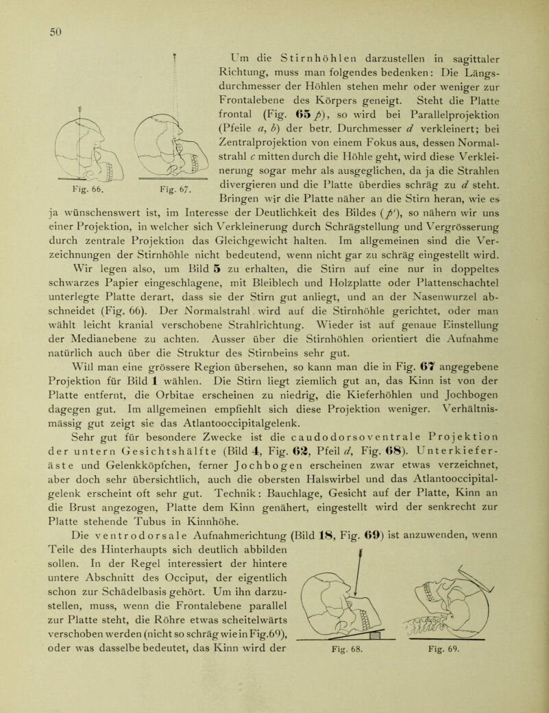 Um die Stirnhöhlen darzustellen in sagittaler Richtung, muss man folgendes bedenken: Die Längs- durchmesser der Höhlen stehen mehr oder weniger zur Frontalebene des Körpers geneigt. Steht die Platte frontal (Fig. 65 p), so wird bei Parallelprojektion (Pfeile a, b) der betr. Durchmesser d verkleinert; bei Zentralprojektion von einem Fokus aus, dessen Normal- strahl c mittendurch die Höhle geht, wird diese Verklei- nerung sogar mehr als ausgeglichen, da ja die Strahlen divergieren und die Platte überdies schräg zu d steht. Bringen wir die Platte näher an die Stirn heran, wie es ja wünschenswert ist, im Interesse der Deutlichkeit des Bildes {p‘), so nähern wir uns einer Projektion, in welcher sich Verkleinerung durch Schrägstellung und Vergrösserung durch zentrale Projektion das Gleichgewicht halten. Im allgemeinen sind die Ver- zeichnungen der Stirnhöhle nicht bedeutend, wenn nicht gar zu schräg eingestellt wird. Wir legen also, um Bild 5 zu erhalten, die Stirn auf eine nur in doppeltes schwarzes Papier eingeschlagene, mit Bleiblech und Holzplatte oder Plattenschachtel unterlegte Platte derart, dass sie der Stirn gut anliegt, und an der Nasenwurzel ab- schneidet (Fig. 66). Der Normalstrahl wird auf die Stirnhöhle gerichtet, oder man wählt leicht kranial verschobene Strahlrichtung. Wieder ist auf genaue Einstellung der Medianebene zu achten. Ausser über die Stirnhöhlen orientiert die Aufnahme natürlich auch über die Struktur des Stirnbeins sehr gut. Will man eine grössere Region übersehen, so kann man die in Fig. 6T angegebene Projektion für Bild 1 wählen. Die Stirn liegt ziemlich gut an, das Kinn ist von der Platte entfernt, die Orbitae erscheinen zu niedrig, die Kieferhöhlen und Jochbogen dagegen gut. Im allgemeinen empfiehlt sich diese Projektion weniger. Verhältnis- mässig gut zeigt sie das Atlantooccipitalgelenk. Sehr gut für besondere Zwecke ist die caudodorsoventrale Projektion der untern Gesichts hälfte (Bild 4, Fig. 63, Pfeil rt7, Fig. 68). Unterkiefer- äste und Gelenkköpfchen, ferner Jochbogen erscheinen zwar etwas verzeichnet, aber doch sehr übersichtlich, auch die obersten Halswirbel und das Atlantooccipital- gelenk erscheint oft sehr gut. Technik: Bauchlage, Gesicht auf der Platte, Kinn an die Brust angezogen, Platte dem Kinn genähert, eingestellt wird der senkrecht zur Platte stehende Tubus in Kinnhöhe. Die ventrodorsale Aufnahmerichtung (Bild 18, Fig. 69) ist anzuwenden, wenn Teile des Hinterhaupts sich deutlich abbilden sollen. In der Regel interessiert der hintere untere Abschnitt des Occiput, der eigentlich schon zur Schädelbasis gehört. Um ihn darzu- stellen, muss, wenn die Frontalebene parallel zur Platte steht, die Röhre etwas scheitelwärts verschoben werden (nicht so schräg wie in Fig.69), oder was dasselbe bedeutet, das Kinn wird der Fig. 68. Fig. 69.