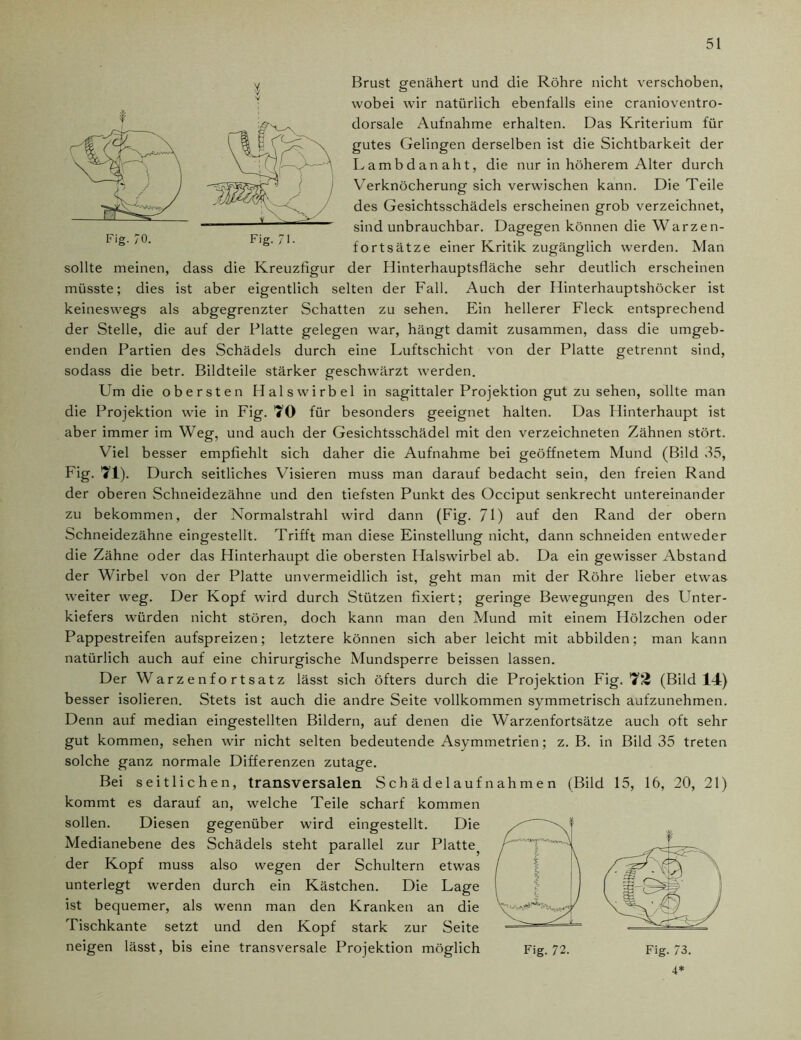 Brust genähert und die Röhre nicht verschoben, wobei wir natürlich ebenfalls eine cranioventro- dorsale Aufnahme erhalten. Das Kriterium für gutes Gelingen derselben ist die Sichtbarkeit der Lambda naht, die nur in höherem Alter durch Verknöcherung sich verwischen kann. Die Teile des Gesichtsschädels erscheinen grob verzeichnet, sind unbrauchbar. Dagegen können die Warzen- fortsätze einer Kritik zugänglich werden. Man sollte meinen, dass die Kreuzfigur der Hinterhauptsfläche sehr deutlich erscheinen müsste; dies ist aber eigentlich selten der Fall. Auch der Hinterhauptshöcker ist keineswegs als abgegrenzter Schatten zu sehen. Ein hellerer Fleck entsprechend der Stelle, die auf der Platte gelegen war, hängt damit zusammen, dass die umgeb- enden Partien des Schädels durch eine Luftschicht von der Platte getrennt sind, sodass die betr. Bildteile stärker geschwärzt werden. Um die obersten Halswirbel in sagittaler Projektion gut zu sehen, sollte man die Projektion wie in Fig. 70 für besonders geeignet halten. Das Hinterhaupt ist aber immer im Weg, und auch der Gesichtsschädel mit den verzeichneten Zähnen stört. Viel besser empfiehlt sich daher die Aufnahme bei geöffnetem Mund (Bild 35, Fig. 71). Durch seitliches Visieren muss man darauf bedacht sein, den freien Rand der oberen Schneidezähne und den tiefsten Punkt des Occiput senkrecht untereinander zu bekommen, der Normalstrahl wird dann (Fig. 71) auf den Rand der obern Schneidezähne eingestellt. Trifft man diese Einstellung nicht, dann schneiden entweder die Zähne oder das Hinterhaupt die obersten Halswirbel ab. Da ein gewisser Abstand der Wirbel von der Platte unvermeidlich ist, geht man mit der Röhre lieber etwas weiter weg. Der Kopf wird durch Stützen fixiert; geringe Bewegungen des Unter- kiefers würden nicht stören, doch kann man den Mund mit einem Hölzchen oder Pappestreifen aufspreizen; letztere können sich aber leicht mit abbilden; man kann natürlich auch auf eine chirurgische Mundsperre beissen lassen. Der Warzenfortsatz lässt sich öfters durch die Projektion Fig. 73 (Bild 14) besser isolieren. Stets ist auch die andre Seite vollkommen symmetrisch anfzunehmen. Denn auf median eingestellten Bildern, auf denen die Warzenfortsätze auch oft sehr gut kommen, sehen wir nicht selten bedeutende Asymmetrien; z. B. in Bild 35 treten solche ganz normale Differenzen zutage. Bei seitlichen, transversalen Schädelaufnahmen (Bild 15, 16, 20, 21) kommt es darauf an, welche Teile scharf kommen sollen. Diesen gegenüber wird eingestellt. Die Medianebene des Schädels steht parallel zur Platte, der Kopf muss also wegen der Schultern etwas unterlegt werden durch ein Kästchen. Die Lage ist bequemer, als wenn man den Kranken an die Tischkante setzt und den Kopf stark zur Seite neigen lässt, bis eine transversale Projektion möglich Fig. 72. 4*