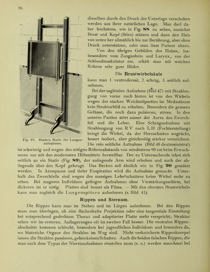 dieselben durch den Druck der Unterlage verschoben werden aus ihrer natürlichen Lage. Man darf da- her höchstens, wie in Fig. 88 zu sehen, zunächst Brust und Kopf (Stirn) stützen und dann den Hals von unten her allmählich bis zur Berührung, aber ohne Druck unterstützen, oder man lässt Patient sitzen. Von den übrigen Gebilden des Halses, ins- besondere vom Zungenbein und Larynx, von der Schlundmuskulatur etc. erhält man mit weichen Röhren sehr gute Bilder. Die Brustwirbelsäule kann man 1. ventrodorsal, 2. schräg, 3. seitlich auf- nehmen. Bei der sagittalen Aufnahme (Bild 47) mit Strahlen- gang von vorne nach hinten ist von den Wirbeln wegen der starken Weichteilpartien im Medastinum kein Strukturbild zu erhalten. Besonders die grossen Gefässe, die noch dazu pulsieren, stören. In den unteren Partien stört ausser der Aorta das Zwerch- fell und die Leber. Eine Schrägaufnahme mit Strahlengang von RV nach LH (Fechterstellung) bringt die Wirbel, da der Herzschatten wegrückt, besser isoliert, aber gleichzeitig stärker verzeichnet. Die rein seitliche Aufnahme (Bild 48 dextrosinistral) ist schwierig und wegen des nötigen Röhrenabstands von mindestens 90 cm beim Erwach- senen nur mit den modernsten Hilfsmitteln herstellbar. Der zu Untersuchende lehnt sich seitlich an ein Stativ (Fig. 89), der anliegende Arm wird erhoben und auch der ab- liegende über den Kopf gebeugt. Das Becken soll ähnlich wie in Fig. 90 gestützt werden. In Atempause und tiefer Exspiration wird die Aufnahme gemacht. Unter- halb des Zwerchfells sind wegen des massigen Leberschattens keine Wirbel mehr zu sehen. Bei mageren Individuen gelingen Aufnahmen ohne Verstärkungsschirm, bei dickeren ist er nötig. Platten sind besser als Films. — Mit den obersten Brustwirbeln kann man zugleich die Lungenspitzen aufnehmen (s. Bild 41). Rippen und Sternum. Die Rippen kann man im Stehen und im Liegen aufnehmen. Bei den Rippen muss man überlegen, ob eine flächenhafte Projektion oder eine tangentiale Einstellung bei entsprechend gedrehtem Thorax und adaptierter Platte mehr verspricht; Struktur sehen wir im ersteren, Auflagerungen oft im zweiten Fall besser. Die ventralen Rippen- abschnitte kommen schlecht, besonders bei jugendlichen Individuen und besonders da, wo blutreiche Organe den Strahlen im Weg sind. Nicht verknöcherte Rippenknorpel lassen die Strahlen passieren, geben keinen Schatten. Auch die beiden falschen Rippen, die man nach dem Typus der Nierenaufnahmen einstellen muss (s. u.) werden manchmal bei Fig. 89. Rieders Stativ für Lungen- aufnahmen.