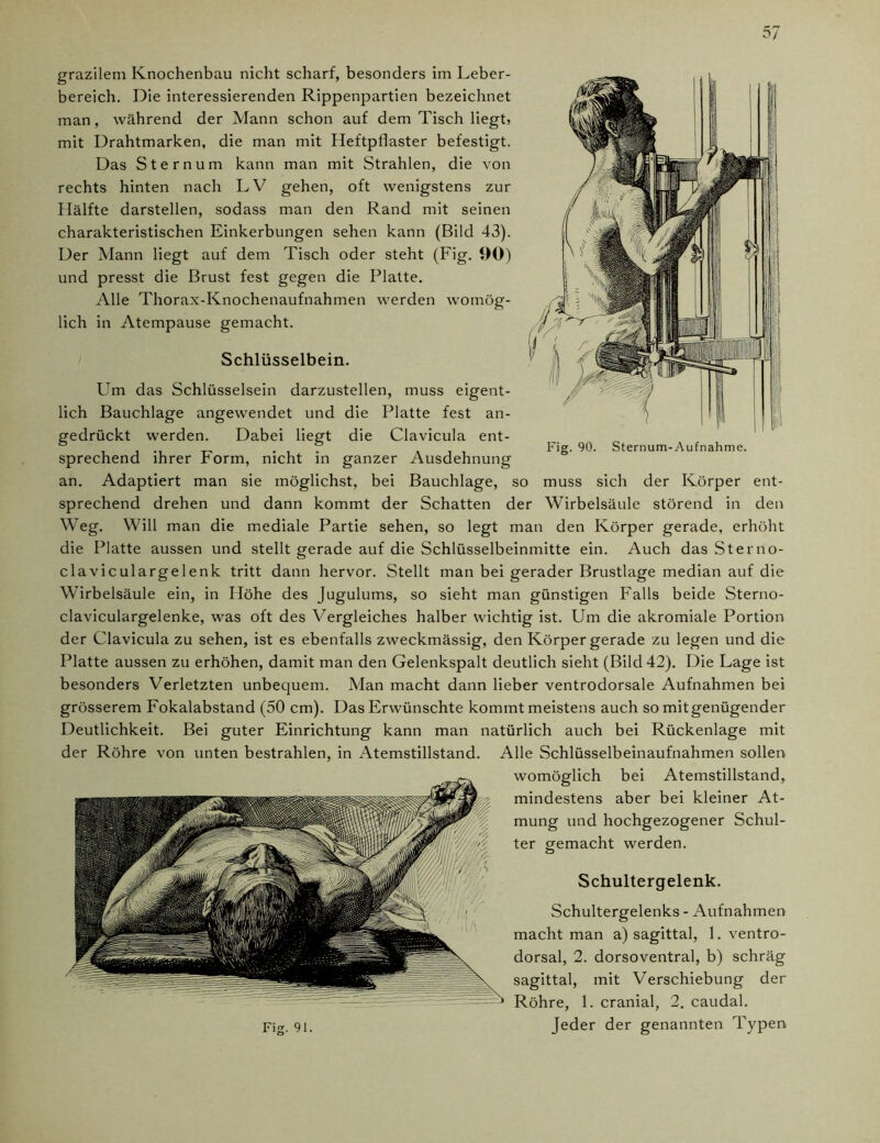 grazilem Knochenbau nicht scharf, besonders im Leber- bereich. Die interessierenden Rippenpartien bezeichnet man, während der Mann schon auf dem Tisch liegt, mit Drahtmarken, die man mit Heftpflaster befestigt. Das Sternum kann man mit Strahlen, die von rechts hinten nach LV gehen, oft wenigstens zur Hälfte darstellen, sodass man den Rand mit seinen charakteristischen Einkerbungen sehen kann (Bild 43). Der Mann liegt auf dem Tisch oder steht (Fig. 90) und presst die Brust fest gegen die Platte. Alle Thorax-Knochenaufnahmen werden womög- lich in Atempause gemacht. Schlüsselbein. Um das Schlüsselsein darzustellen, muss eigent- lich Bauchlage angewendet und die Platte fest an- gedrückt werden. Dabei liegt die Clavicula ent- sprechend ihrer Form, nicht in ganzer Ausdehnung an. Adaptiert man sie möglichst, bei Bauchlage, so muss sich der Körper ent- sprechend drehen und dann kommt der Schatten der Wirbelsäule störend in den Weg. Will man die mediale Partie sehen, so legt man den Körper gerade, erhöht die Platte aussen und stellt gerade auf die Schlüsselbeinmitte ein. Auch das Sterno- claviculargelenk tritt dann hervor. Stellt man bei gerader Brustlage median auf die Wirbelsäule ein, in Höhe des Jugulums, so sieht man günstigen Falls beide Sterno- claviculargelenke, was oft des Vergleiches halber wichtig ist. Um die akromiale Portion der Clavicula zu sehen, ist es ebenfalls zweckmässig, den Körper gerade zu legen und die Platte aussen zu erhöhen, damit man den Gelenkspalt deutlich sieht (Bild 42). Die Lage ist besonders Verletzten unbequem. Man macht dann lieber ventrodorsale Aufnahmen bei grösserem Fokalabstand (50 cm). Das Erwünschte kommt meistens auch so mit genügender Deutlichkeit. Bei guter Einrichtung kann man natürlich auch bei Rückenlage mit der Röhre von unten bestrahlen, in Atemstillstand. Alle Schlüsselbeinaufnahmen sollen womöglich bei Atemstillstand, mindestens aber bei kleiner At- mung und hochgezogener Schul- ter gemacht werden. Schultergelenk. Schultergelenks - Aufnahmen macht man a) sagittal, 1. ventro- dorsal, 2. dorsoventral, b) schräg sagittal, mit Verschiebung der Röhre, 1. cranial, 2. caudal. Fig. 91. Jeder der genannten Typen
