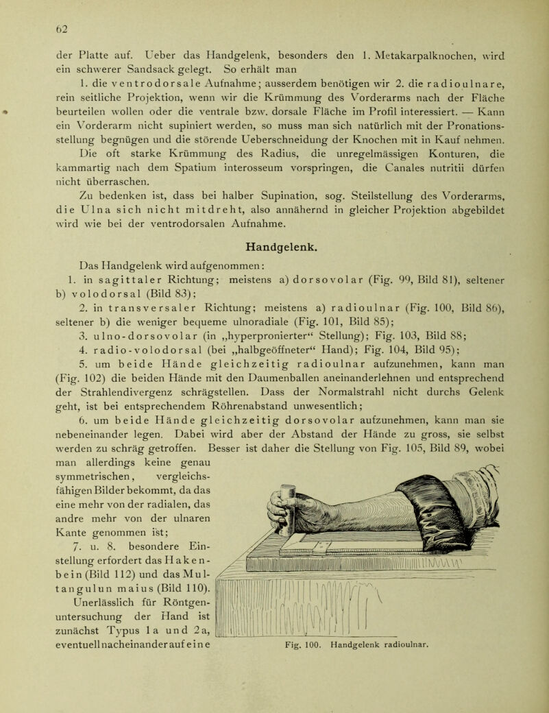 der Platte auf. Ueber das Handgelenk, besonders den 1. Metakarpalknochen, wird ein schwerer Sandsack gelegt. So erhält man 1. die ventrodorsale Aufnahme; ausserdem benötigen wir 2. die radioulnare, rein seitliche Projektion, wenn wir die Krümmung des Vorderarms nach der Fläche beurteilen wollen oder die ventrale bzw. dorsale Fläche im Profil interessiert. — Kann ein Vorderarm nicht supiniert werden, so muss man sich natürlich mit der Pronations- stellung begnügen und die störende Ueberschneidung der Knochen mit in Kauf nehmen. Die oft starke Krümmung des Radius, die unregelmässigen Konturen, die kammartig nach dem Spatium interosseum vorspringen, die Canales nutritii dürfen nicht überraschen. Zu bedenken ist, dass bei halber Supination, sog. Steilstellung des Vorderarms, die Ulna sich nicht mitdreht, also annähernd in gleicher Projektion abgebildet wird wie bei der ventrodorsalen Aufnahme. Handgelenk. Das Handgelenk wird aufgenommen: 1. in sagittaler Richtung; meistens a) dorsovolar (Fig. 99, Bild 81), seltener b) volodorsal (Bild 83) ; 2. in transversaler Richtung; meistens a) radioulnar (Fig. 100, Bild 86), seltener b) die weniger bequeme ulnoradiale (Fig. 101, Bild 85); 3. ulno-dorsovolar (in ,,hyperpronierter“ Stellung); Fig. 103, Bild 88; 4. r ad io - v o lo do r sal (bei „halbgeöffneter“ Hand); Fig. 104, Bild 95); 5. um beide Hände gleichzeitig radioulnar aufzunehmen, kann man (Fig. 102) die beiden Hände mit den Daumenballen aneinanderlehnen und entsprechend der Strahlendivergenz schrägstellen. Dass der Normalstrahl nicht durchs Gelenk geht, ist bei entsprechendem Röhrenabstand unwesentlich; 6. um beide Hände gleichzeitig dorsovolar aufzunehmen, kann man sie nebeneinander legen. Dabei wird aber der Abstand der Hände zu gross, sie selbst werden zu schräg getroffen. Besser ist daher die Stellung von Fig. 105, Bild 89, wobei man allerdings keine genau symmetrischen , vergleichs- fähigen Bilder bekommt, da das eine mehr von der radialen, das andre mehr von der ulnaren Kante genommen ist; 7. u. 8. besondere Ein- stellung erfordert das Haken- bein (Bild 112) und das Mu 1- tangulun maius (Bild 110). Unerlässlich für Röntgen- untersuchung der Hand ist zunächst Typus la und 2a,
