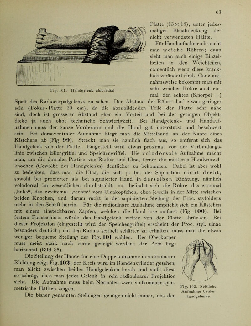 1 jii ii, /1 in i 11- m 41 /(/ 111111 Fig. 101. Handgelenk ulnoradial. Platte (13 X 18), unter jedes- maliger Bleiabdeckung der nicht verwendeten Hälfte. Für Handaufnahmen braucht man weiche Röhren; dann sieht man auch einige Einzel- heiten in den Weichteilen, namentlich wenn diese krank- haft verändert sind. Ganz aus- nahmsweise bekommt man mit sehr weicher Röhre auch ein- mal den echten (Knorpel =) Spalt des Radiocarpalgelenks zu sehen. Der Abstand der Röhre darf etwas geringer sein (Fokus - Platte 30 cm), da die abzubildenden Teile der Platte sehr nahe sind, doch ist grösserer Abstand eher ein Vorteil und bei der geringen Objekt- dicke ja auch ohne technische Schwierigkeit. Bei Handgelenk- und Handauf- nahmen muss der ganze Vorderarm und die Hand gut unterstützt und beschwert sein. Bei dorsoventraler Aufnahme biegt man die Mittelhand an der Kante eines Kistchens ab (Fig. 99). Streckt man sie nämlich flach aus, so entfernt sich das Handgelenk von der Platte. Eingestellt wird etwas proximal von der Verbindungs- linie zwischen Ellengriffel und Speichengriffel. Die volodorsale Aufnahme macht man, um die dorsalen Partien von Radius und Ulna, ferner die mittleren Handwurzel- knochen (Gewölbe des Handgelenks) deutlicher zu bekommen. Dabei ist aber wohl zu bedenken, dass man die Ulna, die sich ja bei der Supination nicht dreht, sowohl bei pronierter als bei supinierter Hand in derselben Richtung, nämlich volodorsal im wesentlichen durchstrahlt, nur befindet sich die Röhre das erstemal ,,links“, das zweitemal „rechts“ vom Ulnaköpfchen, eben jeweils in der Mitte zwischen beiden Knochen, und darum rückt in der supinierten Stellung der Proc. styloideus mehr in den Schaft herein. Für die radioulnare Aufnahme empfiehlt sich ein Kästchen mit einem einsteckbaren Zapfen, welchen die Hand lose umfasst (Fig. 100). Bei festem Faustschluss würde das Handgelenk weiter von der Platte abrücken. Bei dieser Projektion (eingestellt wird der Speichengriffel) erscheint der Proc. styl, ulnae besonders deutlich; um den Radius seitlich schärfer zu erhalten, muss man die etwas weniger bequeme Stellung der Fig. 101 wählen. Der Oberkörper muss meist stark nach vorne geneigt werden; der Arm liegt horizontal (Bild 85). Die Stellung der Hände für eine Doppelaufnahme in radioulnarer Richtung zeigt Fig. 103: der Kreis wird im Blendenzylinder gesehen, man blickt zwischen beiden Handgelenken herab und stellt diese so schräg, dass man jedes Gelenk in rein radioulnarer Projektion sieht. Die Aufnahme muss beim Normalen zwei vollkommen sym- metrische Hälften zeigen. Flg'/°u‘ S<lthche ° Aufnahme beider Die bisher genannten Stellungen genügen nicht immer, uns den Handgelenke.