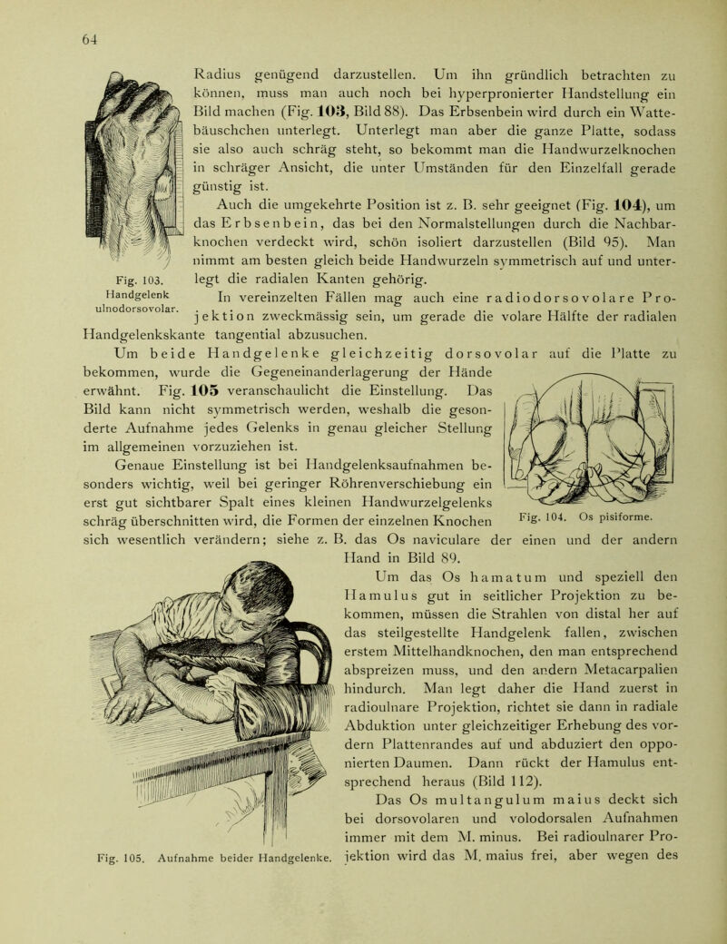 Fig. 103. Handgelenk ulnodorsovolar. Radius genügend darzustellen. Um ihn gründlich betrachten zu können, muss man auch noch bei hyperpronierter Handstellung ein Bild machen (Fig. 103, Bild 88). Das Erbsenbein wird durch ein Watte- bäuschchen unterlegt. Unterlegt man aber die ganze Platte, sodass sie also auch schräg steht, so bekommt man die Handwurzelknochen in schräger Ansicht, die unter Umständen für den Einzelfall gerade günstig ist. Auch die umgekehrte Position ist z. B. sehr geeignet (Fig. 104), um das E r b s e n b e i n, das bei den Normalstellungen durch die Nachbar- knochen verdeckt wird, schön isoliert darzustellen (Bild 95). Man nimmt am besten gleich beide Handwurzeln symmetrisch auf und unter- legt die radialen Kanten gehörig. In vereinzelten Fällen mag auch eine radiodorsovolare Pro- jektion zweckmässig sein, um gerade die volare Hälfte der radialen Handgelenkskante tangential abzusuchen. Um beide Handgelenke gleichzeitig dorsovolar auf die Platte zu bekommen, wurde die Gegeneinanderlagerung der Hände erwähnt. Fig. 105 veranschaulicht die Einstellung. Das Bild kann nicht symmetrisch werden, weshalb die geson- derte Aufnahme jedes Gelenks in genau gleicher Stellung im allgemeinen vorzuziehen ist. Genaue Einstellung ist bei Handgelenksaufnahmen be- sonders wichtig, weil bei geringer Röhrenverschiebung ein erst gut sichtbarer Spalt eines kleinen Handwurzelgelenks schrägüberschnitten wird, die Formen der einzelnen Knochen 104, Pisif0rme- sich wesentlich verändern; siehe z. B. das Os naviculare der einen und der andern Hand in Bild 89. Um das Os hamatum und speziell den Ha mul us gut in seitlicher Projektion zu be- kommen, müssen die Strahlen von distal her auf das steilgestellte Handgelenk fallen, zwischen erstem Mittelhandknochen, den man entsprechend abspreizen muss, und den andern Metacarpalien hindurch. Man legt daher die Hand zuerst in radioulnare Projektion, richtet sie dann in radiale Abduktion unter gleichzeitiger Erhebung des vor- dem Plattenrandes auf und abduziert den oppo- nierten Daumen. Dann rückt der Hamulus ent- sprechend heraus (Bild 112). Das Os multangulum maius deckt sich bei dorsovolaren und volodorsalen Aufnahmen immer mit dem M. minus. Bei radioulnarer Pro- Fig. 105. Aufnahme beider Handgelenke, jektion wird das M. maius frei, aber wegen des