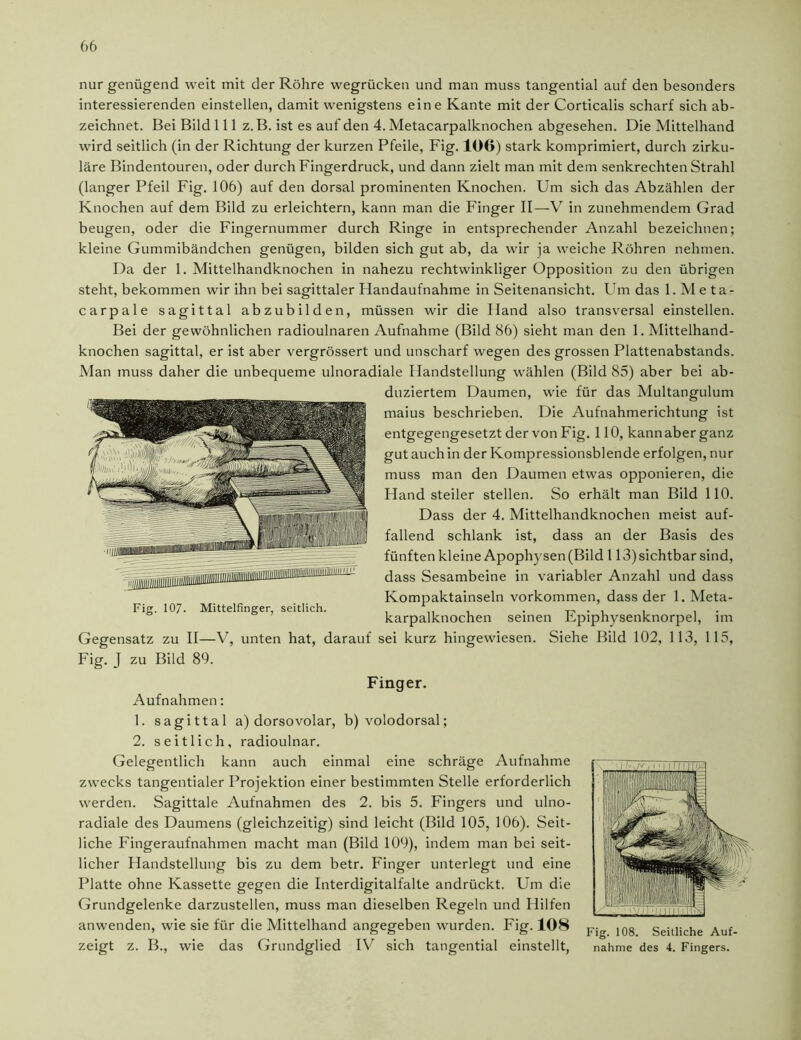 nur genügend weit mit der Röhre wegrücken und man muss tangential auf den besonders interessierenden einstellen, damit wenigstens eine Kante mit der Corticalis scharf sich ab- zeichnet. Bei Bild 111 z. B. ist es auf den 4. Metacarpalknochen abgesehen. Die Mittelhand wird seitlich (in der Richtung der kurzen Pfeile, Fig. 100) stark komprimiert, durch zirku- läre Bindentouren, oder durch Fingerdruck, und dann zielt man mit dem senkrechten Strahl (langer Pfeil Fig. 106) auf den dorsal prominenten Knochen. Um sich das Abzählen der Knochen auf dem Bild zu erleichtern, kann man die Finger II—V in zunehmendem Grad beugen, oder die Fingernummer durch Ringe in entsprechender Anzahl bezeichnen; kleine Gummibändchen genügen, bilden sich gut ab, da wir ja weiche Röhren nehmen. Da der 1. Mittelhandknochen in nahezu rechtwinkliger Opposition zu den übrigen steht, bekommen wir ihn bei sagittaler Handaufnahme in Seitenansicht. Um das 1. Meta- carpale sagittal abzubilden, müssen wir die Iland also transversal einstellen. Bei der gewöhnlichen radioulnaren Aufnahme (Bild 86) sieht man den 1. Mittelhand- knochen sagittal, er ist aber vergrössert und unscharf wegen des grossen Plattenabstands. Man muss daher die unbequeme ulnoradiale Handstellung wählen (Bild 85) aber bei ab- duziertem Daumen, wie für das Multangulum maius beschrieben. Die Aufnahmerichtung ist entgegengesetzt der von Fig. 110, kann aber ganz gut auch in der Kompressionsblende erfolgen, nur muss man den Daumen etwas opponieren, die Handsteiler stellen. So erhält man Bild 110. Dass der 4. Mittelhandknochen meist auf- fallend schlank ist, dass an der Basis des fünften kleine Apophysen(Bild 113)sichtbar sind, dass Sesambeine in variabler Anzahl und dass Kompaktainseln Vorkommen, dass der 1. Meta- karpalknochen seinen Epiphysenknorpel, im Gegensatz zu II—V, unten hat, darauf sei kurz hingewiesen. Siehe Bild 102, 113, 115, Fig. J zu Bild 89. Fig. 107. Mittelfinger, seitlich. Finger. Aufnahmen: 1. sagittal a) dorsovolar, b) volodorsal; 2. seitlich, radioulnar. Gelegentlich kann auch einmal eine schräge Aufnahme zwecks tangentialer Projektion einer bestimmten Stelle erforderlich werden. Sagittale Aufnahmen des 2. bis 5. Fingers und ulno- radiale des Daumens (gleichzeitig) sind leicht (Bild 105, 106). Seit- liche Fingeraufnahmen macht man (Bild 109), indem man bei seit- licher Handstellung bis zu dem betr. Finger unterlegt und eine Platte ohne Kassette gegen die Interdigitalfalte andrückt. Um die Grundgelenke darzustellen, muss man dieselben Regeln und Hilfen anwenden, wie sie für die Mittelhand angegeben wurden. Fig. 108 zeigt z. B., wie das Grundglied IV sich tangential einstellt, Fig. 108. Seitliche Auf- nahme des 4. Fingers.