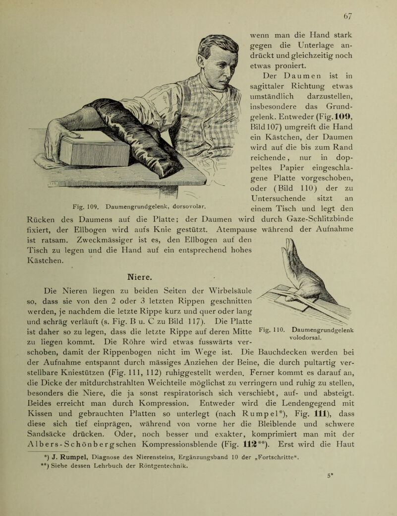 wenn man die Hand stark gegen die Unterlage an- drückt und gleichzeitig noch etwas proniert. Der D aumen ist in sagittaler Richtung etwas umständlich darzustellen, insbesondere das Grund- gelenk. Entweder (Fig. 109, Bild 107) umgreift die Hand ein Kästchen, der Daumen wird auf die bis zum Rand reichende, nur in dop- peltes Papier eingeschla- gene Platte vorgeschoben, oder (Bild 110) der zu Untersuchende sitzt an Fig. 109. Daumengrundgelenk, dorsovolar. einem Tisch und legt den Rücken des Daumens auf die Platte; der Daumen wird durch Gaze-Schlitzbinde fixiert, der Ellbogen wird aufs Knie gestützt. Atempause während der Aufnahme ist ratsam. Zweckmässiger ist es, den Ellbogen auf den Tisch zu legen und die Hand auf ein entsprechend hohes Kästchen. Niere. Fig. 110. Daumengrundgelenk volodorsal. Die Nieren liegen zu beiden Seiten der Wirbelsäule so, dass sie von den 2 oder 3 letzten Rippen geschnitten werden, je nachdem die letzte Rippe kurz und quer oder lang und schräg verläuft (s. Fig. B u. C zu Bild 117). Die Platte ist daher so zu legen, dass die letzte Rippe auf deren Mitte zu liegen kommt. Die Röhre wird etwas fusswärts ver- schoben, damit der Rippenbogen nicht im Wege ist. Die Bauchdecken werden bei der Aufnahme entspannt durch mässiges Anziehen der Beine, die durch pultartig ver- stellbare Kniestützen (Fig. 111, 112) ruhiggestellt werden. Ferner kommt es darauf an, die Dicke der mitdurchstrahlten Weichteile möglichst zu verringern und ruhig zu stellen, besonders die Niere, die ja sonst respiratorisch sich verschiebt, auf- und absteigt. Beides erreicht man durch Kompression. Entweder wird die Lendengegend mit Kissen und gebrauchten Platten so unterlegt (nach Rumpel*), Fig. 111), dass diese sich tief einprägen, während von vorne her die Bleiblende und schwere Sandsäcke drücken. Oder, noch besser und exakter, komprimiert man mit der A1 b e r s - S c h ön b e r g sehen Kompressionsblende (Fig. 113**). Erst wird die Haut *) J. Rumpel, Diagnose des Nierensteins, Ergänzungsband 10 der „Fortschritte“. **) Siehe dessen Lehrbuch der Röntgentechnik. 5*