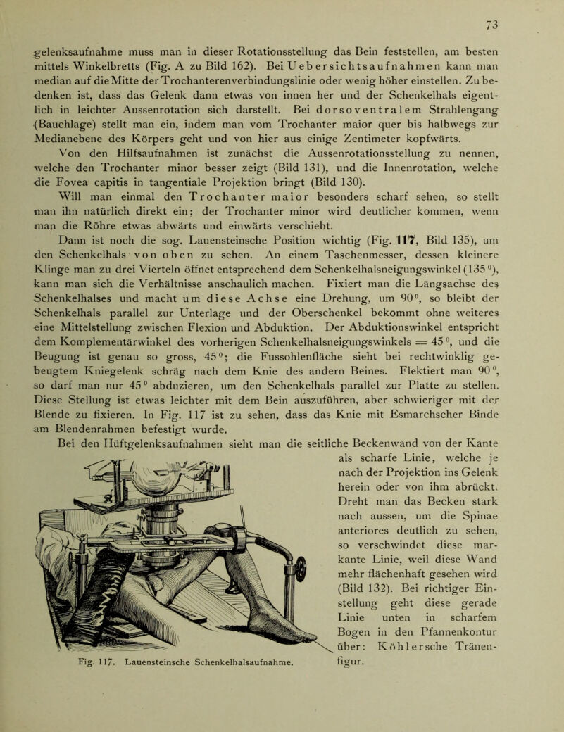 gelenksaufnahme muss man in dieser Rotationsstellung das Bein feststellen, am besten mittels Winkelbretts (Fig. A zu Bild 162). Bei Uebersichtsaufnahmen kann man median auf dieMitte derTrochanterenverbindungslinie oder wenig höher einstellen. Zu be- denken ist, dass das Gelenk dann etwas von innen her und der Schenkelhals eigent- lich in leichter Aussenrotation sich darstellt. Bei dorsoventralem Strahlengang (Bauchlage) stellt man ein, indem man vom Trochanter maior quer bis halbwegs zur Medianebene des Körpers geht und von hier aus einige Zentimeter kopfwärts. Von den Hilfsaufnahmen ist zunächst die Aussenrotationsstellung zu nennen, welche den Trochanter minor besser zeigt (Bild 131), und die Innenrotation, welche die Fovea capitis in tangentiale Projektion bringt (Bild 130). Will man einmal den Trochanter maior besonders scharf sehen, so stellt man ihn natürlich direkt ein; der Trochanter minor wird deutlicher kommen, wenn man die Röhre etwas abwärts und einwärts verschiebt. Dann ist noch die sog. Lauensteinsche Position wichtig (Fig. 1P7, Bild 135), um den Schenkelhals von oben zu sehen. An einem Taschenmesser, dessen kleinere Klinge man zu drei Vierteln öffnet entsprechend dem Schenkelhalsneigungswinkel (135 °), kann man sich die Verhältnisse anschaulich machen. Fixiert man die Längsachse des Schenkelhalses und macht um diese Achse eine Drehung, um 90°, so bleibt der Schenkelhals parallel zur Unterlage und der Oberschenkel bekommt ohne weiteres eine Mittelstellung zwischen Flexion und Abduktion. Der Abduktionswinkel entspricht dem Komplementärwinkel des vorherigen Schenkelhalsneigungswinkels — 45 °, und die Beugung ist genau so gross, 45°; die Fussohlenfläche sieht bei rechtwinklig ge- beugtem Kniegelenk schräg nach dem Knie des andern Beines. Flektiert man 90°, so darf man nur 450 abduzieren, um den Schenkelhals parallel zur Platte zu stellen. Diese Stellung ist etwas leichter mit dem Bein auszuführen, aber schwieriger mit der Blende zu fixieren. In Fig. 117 ist zu sehen, dass das Knie mit Esmarchscher Binde am Blendenrahmen befestigt wurde. Bei den Hüftgelenksaufnahmen sieht man die seitliche Beckenwand von der Kante als scharfe Linie, welche je nach der Projektion ins Gelenk herein oder von ihm abrückt. Dreht man das Becken stark nach aussen, um die Spinae anteriores deutlich zu sehen, so verschwindet diese mar- kante Linie, weil diese Wand mehr flächenhaft gesehen wird (Bild 132). Bei richtiger Ein- stellung geht diese gerade Linie unten in scharfem Bogen in den Pfannenkontur über: Köhl ersehe Tränen- figur. Fig. 117. Lauensteinsche Schenkelhalsaufnahme.