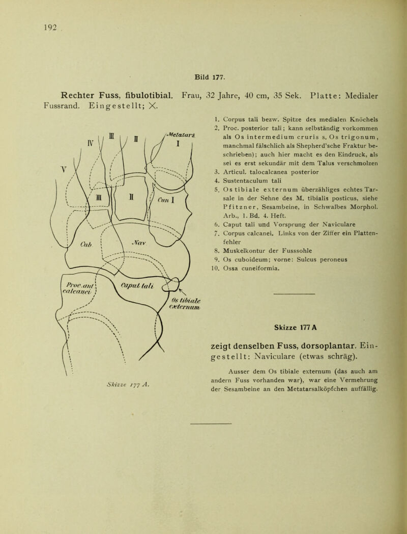 Bild 177. Rechter Fuss, fibulotibial. Frau, Fussrand. Eingestellt; X. 32 Jahre, 40 cm, 35 Sek. Platte: Medialer 1. Corpus tali bezw. Spitze des medialen Knöchels 2. Proc. posterior tali; kann selbständig Vorkommen als Os intermedium cruris s. Os trigonum, manchmal fälschlich als Shepherd’sche Fraktur be- schrieben); auch hier macht es den Eindruck, als sei es erst sekundär mit dem Talus verschmolzen 3. Articul. talocalcanea posterior 4. Sustentaculum tali 5. Ostibiale externum überzähliges echtes Tar- sale in der Sehne des M. tibialis posticus, siehe Pfitzner, Sesambeine, in Schwalbes Morphol. Arb., 1. Bd. 4. Heft. 6. Caput tali und Vorsprung der Naviculare 7. Corpus calcanei. Links von der Ziffer ein Platten- fehler 8. Muskelkontur der Fusssohle 9. Os cuboideum; vorne: Sulcus peroneus 10. Ossa cuneiformia. Skizze 177 A zeigt denselben Fuss, dorsoplantar. Ein- gestellt: Naviculare (etwas schräg). Ausser dem Os tibiale externum (das auch am andern Fuss vorhanden war), war eine Vermehrung der Sesambeine an den Metatarsalköpfchen auffällig.