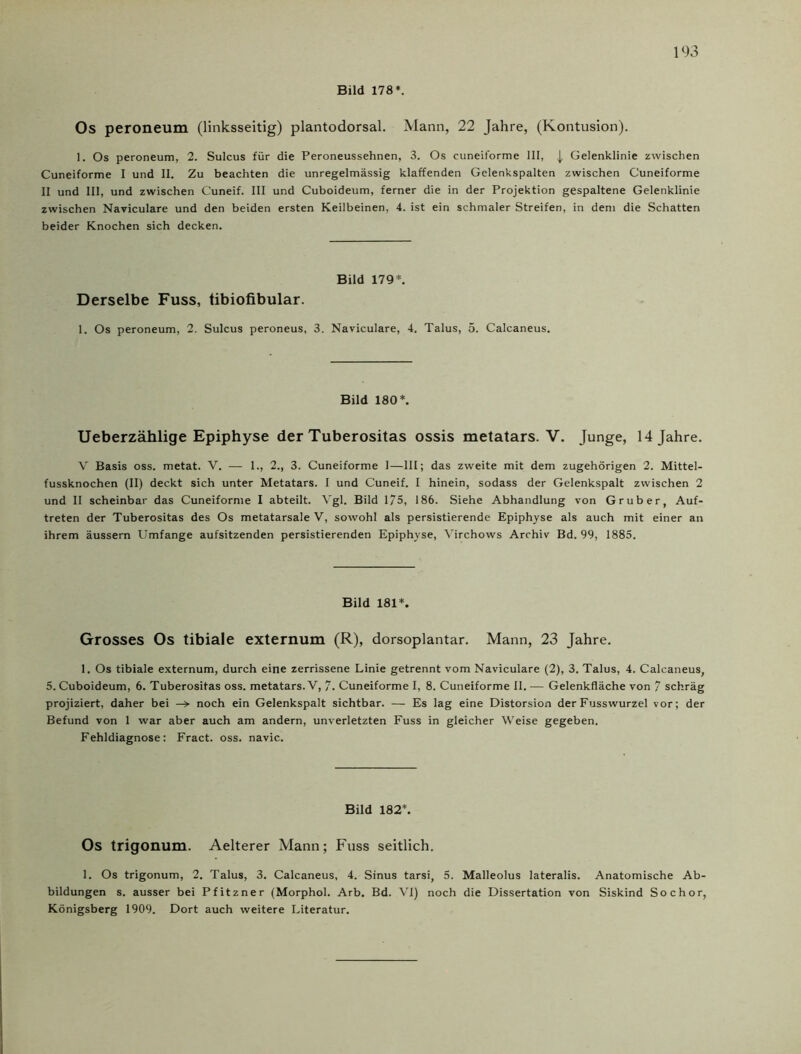 Bild 178*. Os peroneum (linksseitig) plantodorsal. Mann, 22 Jahre, (Kontusion). 1. Os peroneum, 2. Sulcus für die Peroneussehnen, 3. Os cuneiforme III, | Gelenklinie zwischen Cuneiforme I und II. Zu beachten die unregelmässig klaffenden Gelenkspalten zwischen Cuneiforme II und III, und zwischen Cuneif. III und Cuboideum, ferner die in der Projektion gespaltene Gelenklinie zwischen Naviculare und den beiden ersten Keilbeinen, 4. ist ein schmaler Streifen, in dem die Schatten beider Knochen sich decken. Bild 179*. Derselbe Fuss, tibiofibular. 1. Os peroneum, 2. Sulcus peroneus, 3. Naviculare, 4. Talus, 5. Calcaneus. Bild 180*. Ueberzählige Epiphyse der Tuberositas ossis metatars. V. Junge, 14 Jahre. V Basis oss. metat. V. — 1., 2., 3. Cuneiforme 1—III; das zweite mit dem zugehörigen 2. Mittel- fussknochen (II) deckt sich unter Metatars. I und Cuneif. I hinein, sodass der Gelenkspalt zwischen 2 und II scheinbar das Cuneiforme I abteilt. Vgl. Bild 175, 186. Siehe Abhandlung von Grub er, Auf- treten der Tuberositas des Os metatarsale V, sowohl als persistierende Epiphyse als auch mit einer an ihrem äussern Umfange aufsitzenden persistierenden Epiphyse, Virchows Archiv Bd. 99, 1885. Bild 181*. Grosses Os tibiale externum (R), dorsoplantar. Mann, 23 Jahre. 1. Os tibiale externum, durch eine zerrissene Linie getrennt vom Naviculare (2), 3. Talus, 4. Calcaneus, 5. Cuboideum, 6. Tuberositas oss. metatars. V, 7. Cuneiforme I, 8. Cuneiforme II. — Gelenkfläche von 7 schräg projiziert, daher bei —> noch ein Gelenkspalt sichtbar. — Es lag eine Distorsion der Fusswurzel vor; der Befund von 1 war aber auch am andern, unverletzten Fuss in gleicher Weise gegeben. Fehldiagnose: Fract. oss. navic. Bild 182*. Os trigonum. Aelterer Mann; Fuss seitlich. 1. Os trigonum, 2. Talus, 3. Calcaneus, 4. Sinus tarsi, 5. Malleolus lateralis. Anatomische Ab- bildungen s. ausser bei Pfitzner (Morphol. Arb. Bd. VI) noch die Dissertation von Siskind So c hör, Königsberg 1909. Dort auch weitere Literatur.
