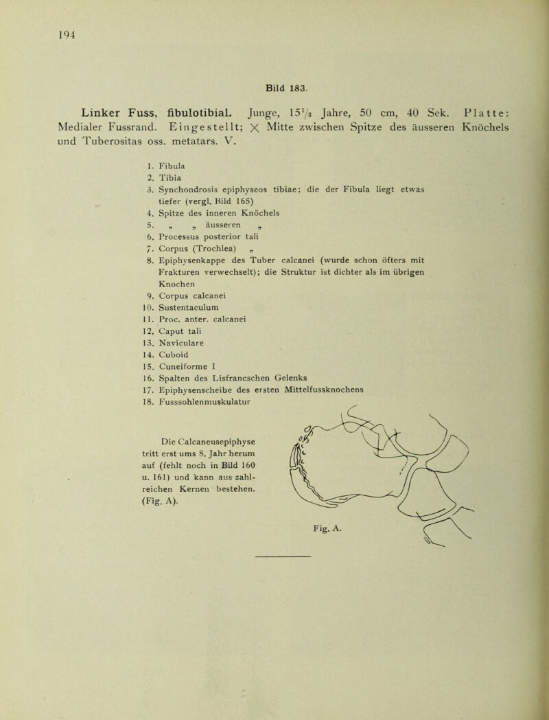 Bild 183. Linker Fuss, fibulotibial. Junge, 15l/2 Jahre, 50 cm, 40 Sek. Platte: Medialer Fussrand. Eingestellt; X Mitte zwischen Spitze des äusseren Knöchels und Tuberositas oss. metatars. V. 1. Fibula 2. Tibia 3. Synchondrosis epiphyseos tibiae; die der Fibula liegt etwas tiefer (vergl. Bild 165) 4. Spitze des inneren Knöchels 5. * v äusseren „ 6. Processus posterior tali 7. Corpus (Trochlea) „ 8. Epiphysenkappe des Tuber calcanei (wurde schon öfters mit Frakturen verwechselt); die Struktur ist dichter als im übrigen Knochen 9. Corpus calcanei 10. Sustentaculum 11. Proc. anter. calcanei 12. Caput tali 13. Naviculare 14. Cuboid 15. Cuneiforme I 16. Spalten des Lisfrancschen Gelenks 17- Epiphysenscheibe des ersten Mittelfussknochens 18. Fusssohlenmuskulatur Die Calcaneusepiphyse tritt erst ums 8. Jahr herum auf (fehlt noch in Bild 160 u. 161) und kann aus zahl- reichen Kernen bestehen. (Fig. A). Fig. A.