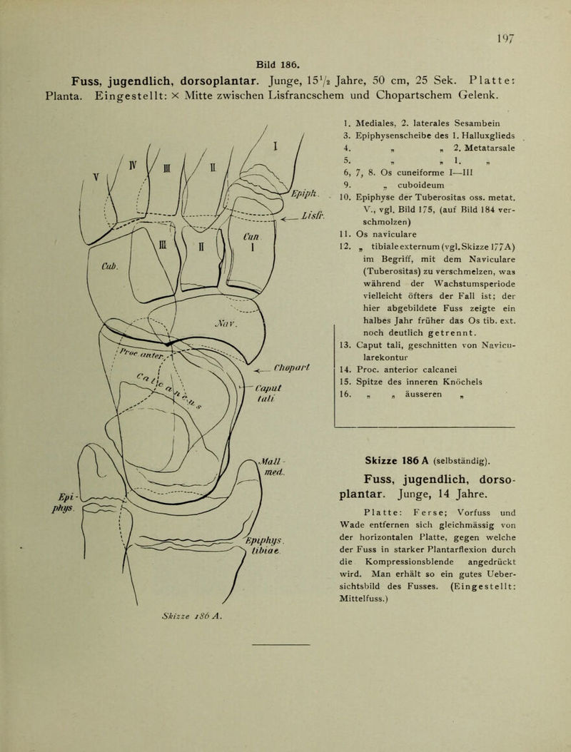 Bild 186. Fuss, jugendlich, dorsoplantar. Junge, 15a/2 Jahre, 50 cm, 25 Sek. Platte: Planta. Eingestellt: x Mitte zwischen Lisfrancschem und Chopartschem Gelenk. 1. Mediales, 2. laterales Sesambein 3. Epiphysenscheibe des 1. Halluxglieds 4. „ „2. Metatarsale V » 1 . T» 6, 7, 8. Os cuneiforme I—III 9. „ cuboideum 10. Epiphyse der Tuberositas oss. metat. V., vgl. Bild 1/5, (auf Bild 184 ver- schmolzen) 11. Os naviculare 12. „ tibialeexternum (vgl.Skizze 17/A) im Begriff, mit dem Naviculare (Tuberositas) zu verschmelzen, was während der Wachstumsperiode vielleicht öfters der Fall ist; der hier abgebildete Fuss zeigte ein halbes Jahr früher das Os tib. ext. noch deutlich getrennt. 13. Caput tali, geschnitten von Navicu- larekontur 14. Proc. anterior calcanei 15. Spitze des inneren Knöchels 16. „ „ äusseren „ Skizze 186 A (selbständig). Fuss, jugendlich, dorso- plantar. Junge, 14 Jahre. Platte: Ferse; Vorfuss und Wade entfernen sich gleichmässig von der horizontalen Platte, gegen welche der Fuss in starker Plantarflexion durch die Kompressionsblende angedrückt wird. Man erhält so ein gutes Ueber- sichtsbild des Fusses. (Eingestellt: Mittelfuss.) Skizze iS6 A.