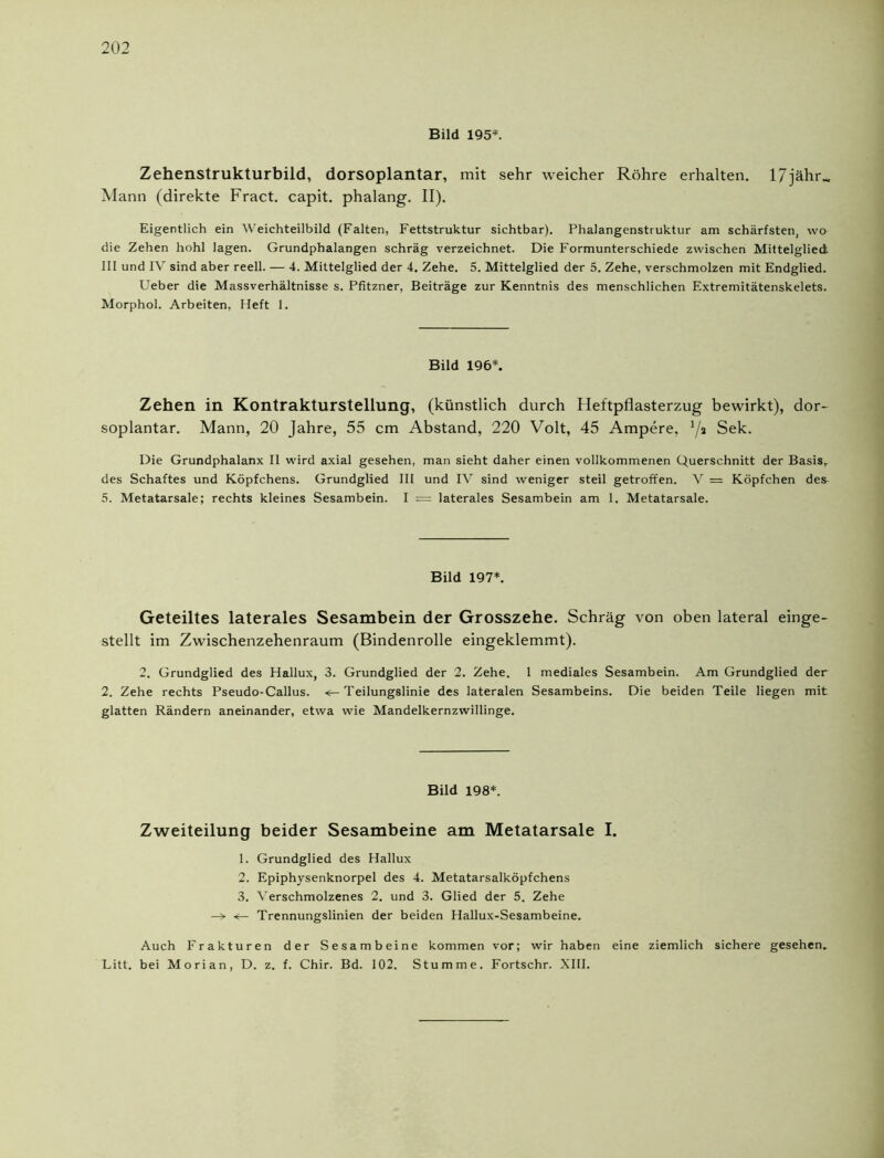 Bild 195*. Zehenstrukturbild, dorsoplantar, mit sehr weicher Röhre erhalten. 17jähr_ Mann (direkte Fract. capit. phalang. II). Eigentlich ein Weichteilbild (Falten, Fettstruktur sichtbar). Phalangenstruktur am schärfsten, wo die Zehen hohl lagen. Grundphalangen schräg verzeichnet. Die Formunterschiede zwischen Mittelglied III und IV sind aber reell. — 4. Mittelglied der 4. Zehe. 5. Mittelglied der 5. Zehe, verschmolzen mit Endglied. Ueber die Massverhältnisse s. Pfitzner, Beiträge zur Kenntnis des menschlichen Extremitätenskelets. Morphol. Arbeiten, Heft 1. Bild 196*. Zehen in Kontrakturstellung, (künstlich durch Heftpflasterzug bewirkt), dor- soplantar. Mann, 20 Jahre, 55 cm Abstand, 220 Volt, 45 Ampere, ’/a Sek. Die Grundphalanx II wird axial gesehen, man sieht daher einen vollkommenen Querschnitt der Basis, des Schaftes und Köpfchens. Grundglied III und IV sind weniger steil getroffen. V = Köpfchen des 5. Metatarsale; rechts kleines Sesambein. I = laterales Sesambein am 1. Metatarsale. Bild 197*. Geteiltes laterales Sesambein der Grosszehe. Schräg von oben lateral einge- stellt im Zwischenzehenraum (Bindenrolle eingeklemmt). 2. Grundglied des Hallux, 3. Grundglied der 2. Zehe. 1 mediales Sesambein. Am Grundglied der 2. Zehe rechts Pseudo-Callus. <— Teilungslinie des lateralen Sesambeins. Die beiden Teile liegen mit glatten Rändern aneinander, etwa wie Mandelkernzwillinge. Bild 198*. Zweiteilung beider Sesambeine am Metatarsale I. 1. Grundglied des Hallux 2. Epiphysenknorpel des 4. Metatarsalköpfchens 3. Verschmolzenes 2. und 3. Glied der 5. Zehe —> <— Trennungslinien der beiden Hallux-Sesambeine. Auch Frakturen der Sesambeine kommen vor; wir haben eine ziemlich sichere gesehen. Litt, bei Morian, D. z. f. Chir. Bd. 102. Stumme. Fortschr. XIII.