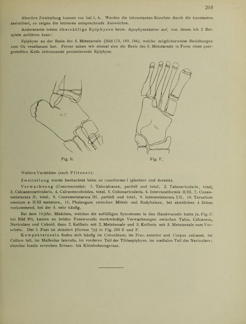 Abortive Zweiteilung kommt vor bei 1, 6. Werden die inkonstanten Knochen durch die konstanten assimiliert, so zeigen die letzteren entsprechende Auswüchse. Andererseits treten überzählige Epiphysen bezw. Apophysenkerne auf, von denen ich 2 Bei- spiele anführen kann: Epiphyse an der Basis des 5. Metatarsale (Bild 175, 180, 186), welche möglicherweise Beziehungen zum Os vesalianum hat. Ferner sahen wir einmal eine die Basis des 5. Metatarsale in Form eines quer- gestellten Keils abtrennende persistierende Epiphyse. Weitere Varietäten (nach Pfitzner): Zweiteilung wurde beobachtet beim os cuneiforme I (plantare und dorsale). Verwachsung (Concrescentia): 1. Talocalcanea, partiell und total, 2. Talonavicularis, total, 3. Calcaneonavicularis, 4. Calcaneocuboidea, total, 5. Cubonavicularis, 6. Intercuneiformis II/III, 7. Cuneo- metatarsea II, total, 8. Cuneometatarsea III, partiell und total, 9. Intermetatarsea I/II, 10. Tarsalium omnium -f- II/'III metatars., 11. Phalangum zwischen Mittel- und Endphalanx, bei sämtlichen 4 Zehen vorkommend, bei der 5. sehr häufig. Bei dem lOjähr. Mädchen, welches die auffälligen Synostosen in den Handwurzeln hatte (s. Fig. C bei Bild 89), kamen an beiden Fusswurzeln merkwürdige Verwachsungen zwischen Talus, Calcaneus, Naviculare und Cuboid, dann 2. Keilbein mit 2. Metatarsale und 3. Keilbein mit 3. Metatarsale zum Vor- schein. Der 1. Fuss ist skizziert (Grösse */2) 1° Fig- 200 E und F. Kompaktainseln finden sich häufig im Cuboideum, im Proc. anterior und Corpus calcanei, im Collum tali, im Malleolus lateralis, im vorderen Teil der Tibiaepiphyse, im medialen Teil des Naviculare: einzelne Inseln erreichen Erbsen- bis Kleinbohnengrösse. Fig. E. Fig. F.