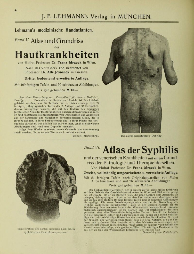 J. F. LEHMANN’s Verlag in MÜNCHEN. Lehmann’s medizinische Handatlanten. Band v. Atlas uncj Grundriss der Hautkrankheiten von Hofrat Professor Dr. Franz Mracek in Wien. Nach des Verfassers Tod bearbeitet von Professor Dr. Alb.Jesionek in Giessen. Dritte, bedeutend erweiterte Auflage. Mit 109 farbigen Tafeln und 96 schwarzen Abbildungen. Preis gut gebunden M. 18.—. Aus einer Besprechung im ,,Zentralblatt fiir innere Medizin“, Leipzig: .... Namentlich in illustrativer Hinsicht ist das Höchste geleistet worden, was die Technik nur zu bieten vermag. Den 77 farbigen, lithographischen Tafeln der 2. Auflage sind 32 Dreifarben- drucke hinzugefügt worden, die mit den Bildern des bekannten Jacobi’schen Atlas der Hautkrankheiten durchaus konkurrieren können. Es sind grösstenteils Reproduktionen von Oelgemälden und Aquarellen aus der Sammlung der Münchener dermatologischen Klinik, die in ihrer Weichheit, in ihrer Farbabtönung und in ihrer Plastik das Voll- endetste darstellen, was bildlich sich erzielen lässt. Auch die schwarzen Abbildungen sind rund ums Doppelte vermehrt. Möge dem Werke in seinem neuen Gewände die Anerkennung zuteil werden, die es seinem Werte nach vollauf verdient. Wenzel (Magdeburg). Dermatitis herpettforniis Duhring. Sequestration des harten Gaumens nach einem syphilitischen Destruktionsprozesse. BandVL ^|a§ ^ SyphlÜS und der venerischen Krankheiten mit einem Grund- riss der Pathologie und Therapie derselben. Von Hofrat Professor Dr. Franz Mracek in Wien. Zweite, vollständig umgearbeitete u. vermehrte Auflage. Mit 81 farbigen Tafeln nach Originalaquarellen von Maler A. Schmitson und mit 26 schwarzen Abbildungen. Preis gut gebunden M. 16.—. Der hochverdiente Verfasser, der in diesem Werke seine grosse Erfahrung auf dem Gebiete der Geschlechtskrankheiten in Wort und Bild niedergelegt hat, ist gerade, als er im Begriffe war, die neue Auflage zum Abschluss zu bringen, dahingegangen. Aber er hat den Text selbst noch durchgearbeitet und zu den alten Bildern 10 neue farbige Tafeln und 14 schwarze Abbildungen hinzugefügt. Die neuen Forschungsergebnisse sind bei der Darstellung der Syphilis weitgehend berücksichtigt; auch in den übrigen Kapiteln ist die Schilderung dem neuesten Stande der Wissenschaft entsprechend. Ausser- ordentlich anerkennenswert ist die Klarheit und Ucbersichtlichkeit des kurz gefassten, aber alles Wesentliche bringenden Textes. Sowohl die farbigen wie die schwarzen Bilder sind ausgezeichnet und geben eine selten vollstän- dige und sehr reichhaltige Illustration der venerischen Krankheiten. So wird der Wunsch der Verlagsbuchhandlung, dass die neue Auflage, die der Ver- fasser mit grösstem Eifer bestrebt war, den höchsten Anforderungen der Wissenschaft gemäss auszugestalten, recht vielen ein schönes Vermächtnis des Verstorbenen sein möge, sich gewiss erfüllen. Ein würdiges Denkmal ist es, das der zu früh der Wissenschaft Entrissene sich gesetzt hat! ,, Dermatologische Zeitschrift“.
