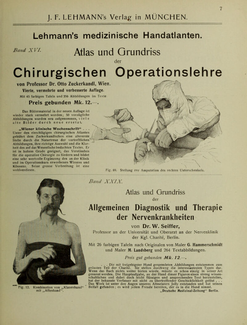 J. F. LEHMANN’s Verlag in MÜNCHEN. LehmanrVs medizinische Handatlanten. Band XVI. Atlas und Grundriss der Chirurgischen Operationslehre Vierte, vermehrte und verbesserte Auflage. von Professor Dr. Otto Zuckerkandl, Wien. Mit 45 farbigen Tafeln und 356 Abbildungen im Texte Preis gebunden Mk. 12.—. Das Bildermaterial in der neuen Auflage ist wieder stark vermehrt worden; 50 vorzügliche Abbildungen wurden neu aufgenommen, viele alte Bilder durch neue ersetzt. „Wiener klinische Wochenschrift“ . . . Unter den einschlägigen chirurgischen Atlanten gebührt dem Zuckerkandlschen eine allererste Stelle durch die Naturtreue der vortrefflichen’- ~ Abbildungen, ihre richtige Auswahl und die Klar- heit des auf das Wesentliche bedachten Textes. Er ist in hohem Grade geeignet, das Verständnis für die operative Chirurgie zu fördern und bildet eine sehr wertvolle Ergänzung des an der Klinik und im Operationskurs erworbenen Wissens und Könnens. Seine grosse Verbreitung ist eine wohlverdiente. \ ' Fig. 89. Stellung zur Amputation des rechten Unterschenkels. Fig. 12. Kombination von „Klauenhand“ mit „Affenhand“. Band XXIX. Atlas und Grundriss der Allgemeinen Diagnostik und Therapie der Nervenkrankheiten von Dr. W. Seiffer, Professor an der Universität und Oberarzt an der Nervenklinik der Kg!. Charite, Berlin. Mit 26 farbigen Tafeln nach Originalen von Maler G. Hammerschmidt und Maler M. Landsberg und 264 Textabbildungen. Preis gut gebunden Mk. 12.—. . . . Die mit freigebigster Hand gespendeten Abbildungen entstammen zum grössten Teil der Charite. Sie stellen durchweg die interessantesten Typen dar. Wenn das Buch nichts weiter bieten würde, müsste es schon einzig in seiner Art genannt werden. Die Hauptaufgabe, an der Hand dieser Figuren einen streng wissen- schaftlichen und dabei doch leicht flüssigen und ansprechenden Text herzustellen, hat der bekannte Verfasser mit nicht zu übertreffender Geschicklichkeit gelöst . . . Das Werk ist unter den Augen unseres Altmeisters Jolly entstanden und hat seinen Beifall gefunden ; es wird jedem Freude bereiten, der es in die Hand nimmt. „Deutsche Medizinal-Zeitung“ Berlin.