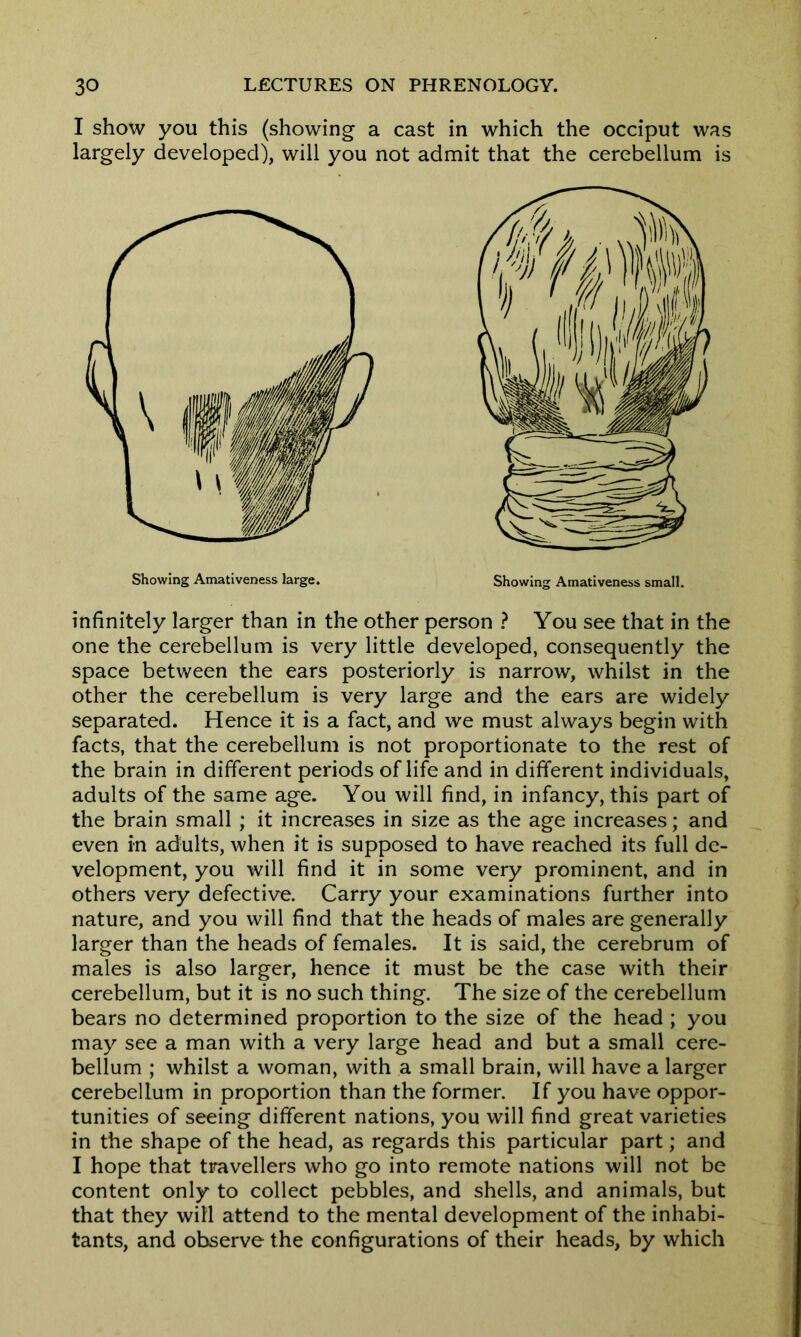 I show you this (showing a cast in which the occiput was largely developed), will you not admit that the cerebellum is infinitely larger than in the other person ? You see that in the one the cerebellum is very little developed, consequently the space between the ears posteriorly is narrow, whilst in the other the cerebellum is very large and the ears are widely separated. Hence it is a fact, and we must always begin with facts, that the cerebellum is not proportionate to the rest of the brain in different periods of life and in different individuals, adults of the same age. You will find, in infancy, this part of the brain small ; it increases in size as the age increases; and even in adults, when it is supposed to have reached its full de- velopment, you will find it in some very prominent, and in others very defective. Carry your examinations further into nature, and you will find that the heads of males are generally larger than the heads of females. It is said, the cerebrum of males is also larger, hence it must be the case with their cerebellum, but it is no such thing. The size of the cerebellum bears no determined proportion to the size of the head ; you may see a man with a very large head and but a small cere- bellum ; whilst a woman, with a small brain, will have a larger cerebellum in proportion than the former. If you have oppor- tunities of seeing different nations, you will find great varieties in the shape of the head, as regards this particular part; and I hope that travellers who go into remote nations will not be content only to collect pebbles, and shells, and animals, but that they will attend to the mental development of the inhabi- tants, and observe the configurations of their heads, by which Showing Amativeness large, Showing Amativeness small.