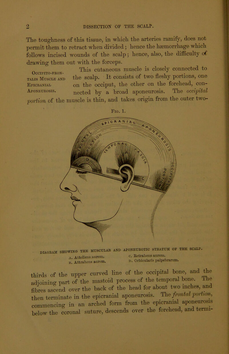 The toughness of this tissue, in which the arteries ramify, does not permit them to retract when divided; hence the haemorrhage which follows incised wounds of the scalp; hence, also, the difficulty of drawing them out with the forceps. _ This cutaneous muscle is closely connected to TALIS Muscle and the scalp. It consists of two fleshy portions, one Epicranial on the occiput, the other on the forehead, con- Aponeurosis. nected by a broad aponeurosis. The occipital portion of the muscle is thin, and takes origin from the outer two- Fig. 1. diagram showing the muscular and aponeurotic stratum oe the scalp, a Attollens aurem. c. Retrains aurem. u. Attrahens aurem. D. Orbicularis palpebrarum. thirds of the upper curved line of the occipital bone, and the adioining part of the mastoid process of the temporal bone, llie fibres ascend over the back of the head for about two inches, and then terminate in the epicranial aponeurosis. The frontal portim, commencing in an arched form from the epicranial aponeurosis below the coronal suture, descends over the forehead, and terim-