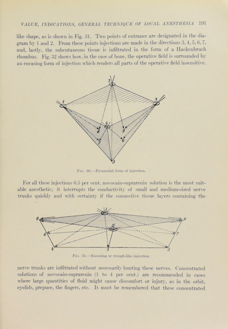 like shape, as is shown in Fig. 31. Two points of entrance are designated in the dia- gram by 1 and 2. From these points injections are made in the directions 3, 4, 5, 6, 7, and, lastly, the subcutaneous tissue is infiltrated in the form of a Hackenbruch rhombus. Fig. 32 shows how, in the case of bone, the operative fielt! is surrounded by an encasing form of injection which renders all parts of the operative fielt! insensitive. Fig. 30.—Pyramidal form of injection. For all these injections 0.5 per cent. novocain-suprarenin solution is the most suit- able anesthetic; it interrupts the conductivity of small and medium-sized nerve trunks quickly and with certainty if the connective tissue layers containing the nerve trunks are infiltrated without necessarily hunting these nerves. Concentrated Solutions of novocain-suprarenin (1 to 4 per cent.) are recommended in cases where large quantities of fluid might cause discomfort or injury, as in the orbit, eyelids, prepuce, the fingers, etc. 1t must be remembered that these concentrated