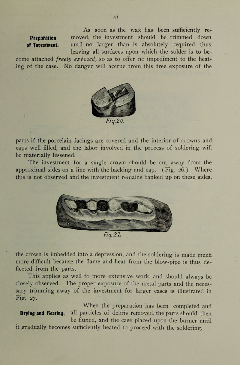 As soon as the wax has been sufficiently re- Prcparation moved, the investment should be trimmed down Of Investment. until no larger than is absolutely required, thus leaving all surfaces upon which the solder is to be- come attached freely exposed, so as to offer no impediment to the heat- ing of the case. No danger will accrue from this free exposure of the Ficj.26. parts if the porcelain facings are covered and the interior of crowns and caps well filled, and the labor involved in the process of soldering will be materially lessened. The investment for a single crown should be cut away from the approximal sides on a line with the backing and cap. (Fig. 26.) Where this is not observed and the investment remains banked up on these sides, Ficj.27. the crown is imbedded into a depression, and the soldering is made much more difficult because the flame and heat from the blow-pipe is thus de- flected from the parts. This applies as well to more extensive work, and should always be closely observed. The proper exposure of the metal parts and the neces- sary trimming away of the investment for larger cases is illustrated in Fig. 27. When the preparation has been completed and Drying and Seating, all particles of debris removed, the parts should then be fluxed, and the case placed upon the burner until it gradually becomes sufficiently heated to proceed with the soldering.