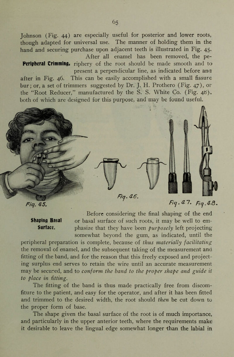 Johnson (Fig. 44) are especially useful for posterior and lower roots, though adapted for universal use. The manner of holding them in the hand and securing purchase upon adjacent teeth is illustrated in Fig. 45. After all enamel has been removed, the pe- Peripberal trimming, riphery of the root should be made smooth and to present a perpendicular line, as indicated before ana after in Fig. 46. This can be easily accomplished with a small fissure bur; or, a set of trimmers suggested by Dr. J. H. Prothero (Fig. 47), or the “Root Reducer,” manufactured by the S. S. White Co. (Fig. 48)* both of which are designed for this purpose, and may be found useful. Before considering the final shaping of the end Shaping Basal or basal surface of such roots, it may be well to env Surface. phasize that they have been purposely left projecting somewhat beyond the gum, as indicated, until the peripheral preparation is complete, because of thus materially facilitating the removal of enamel, and the subsequent taking of the measurement and fitting of the band, and for the reason that this freely exposed and project - ing surplus end serves to retain the wire until an accurate measurement may be secured, and to conform the band to the proper shape and guide ii to place in fitting. The fitting of the band is thus made practically free from discom- fiture to the patient, and easy for the operator, and after it has been fitted and trimmed to the desired width, the root should then be cut down to the proper form of base. The shape given the basal surface of the root is of much importance, and particularly in the upper anterior teeth, where the requirements make it desirable to leave the lingual edge somewhat longer than the labial in