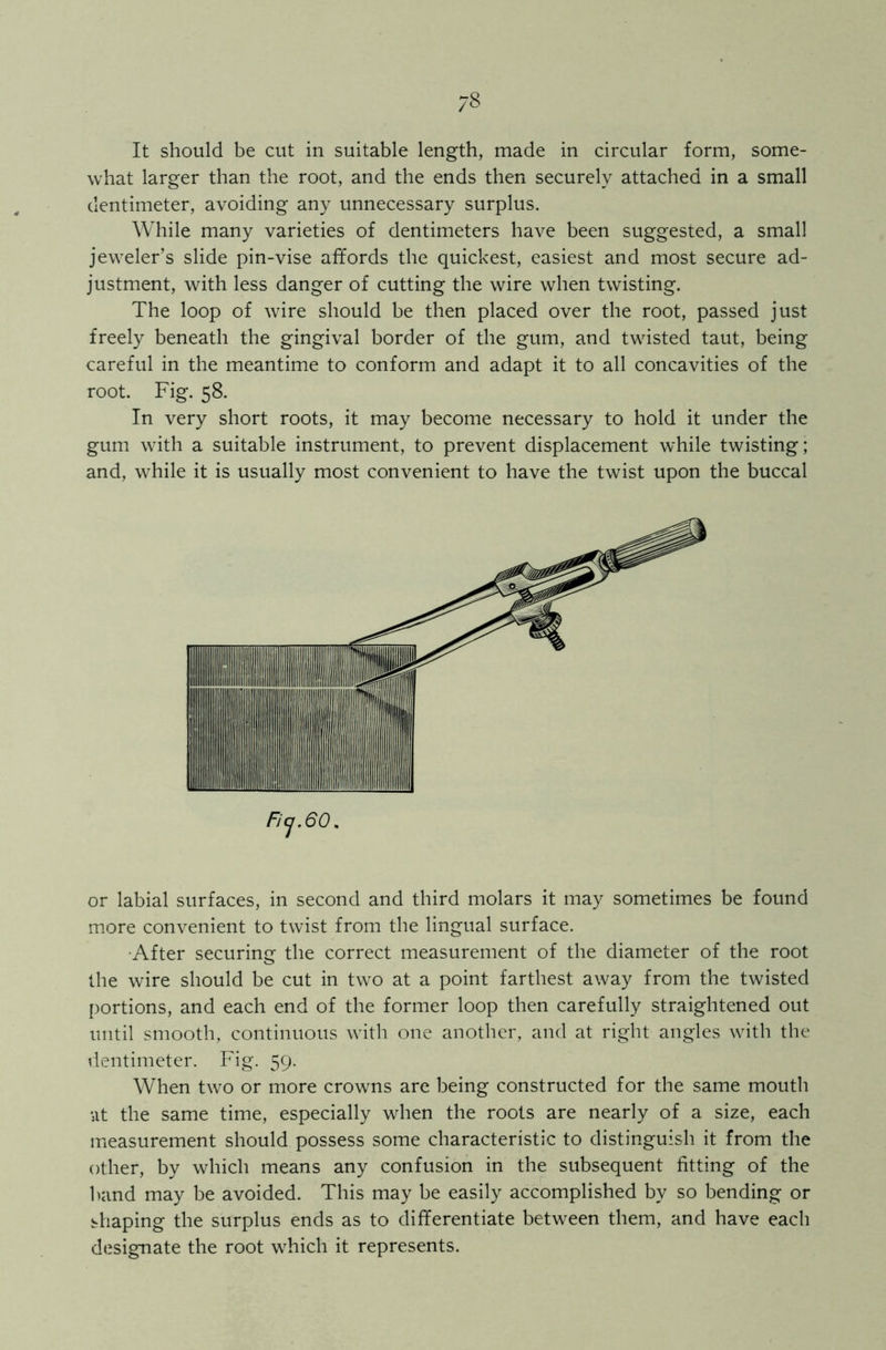 It should be cut in suitable length, made in circular form, some- what larger than the root, and the ends then securely attached in a small dentimeter, avoiding any unnecessary surplus. While many varieties of dentimeters have been suggested, a small jeweler’s slide pin-vise affords the quickest, easiest and most secure ad- justment, with less danger of cutting the wire when twisting. The loop of wire should be then placed over the root, passed just freely beneath the gingival border of the gum, and twisted taut, being careful in the meantime to conform and adapt it to all concavities of the root. Fig. 58. In very short roots, it may become necessary to hold it under the gum with a suitable instrument, to prevent displacement while twisting; and, while it is usually most convenient to have the twist upon the buccal or labial surfaces, in second and third molars it may sometimes be found more convenient to twist from the lingual surface. •After securing the correct measurement of the diameter of the root the wire should be cut in two at a point farthest away from the twisted portions, and each end of the former loop then carefully straightened out until smooth, continuous with one another, and at right angles with the dentimeter. Fig. 59. When two or more crowns are being constructed for the same mouth at the same time, especially when the roots are nearly of a size, each measurement should possess some characteristic to distinguish it from the other, by which means any confusion in the subsequent fitting of the band may be avoided. This may be easily accomplished by so bending or shaping the surplus ends as to differentiate between them, and have each designate the root which it represents.