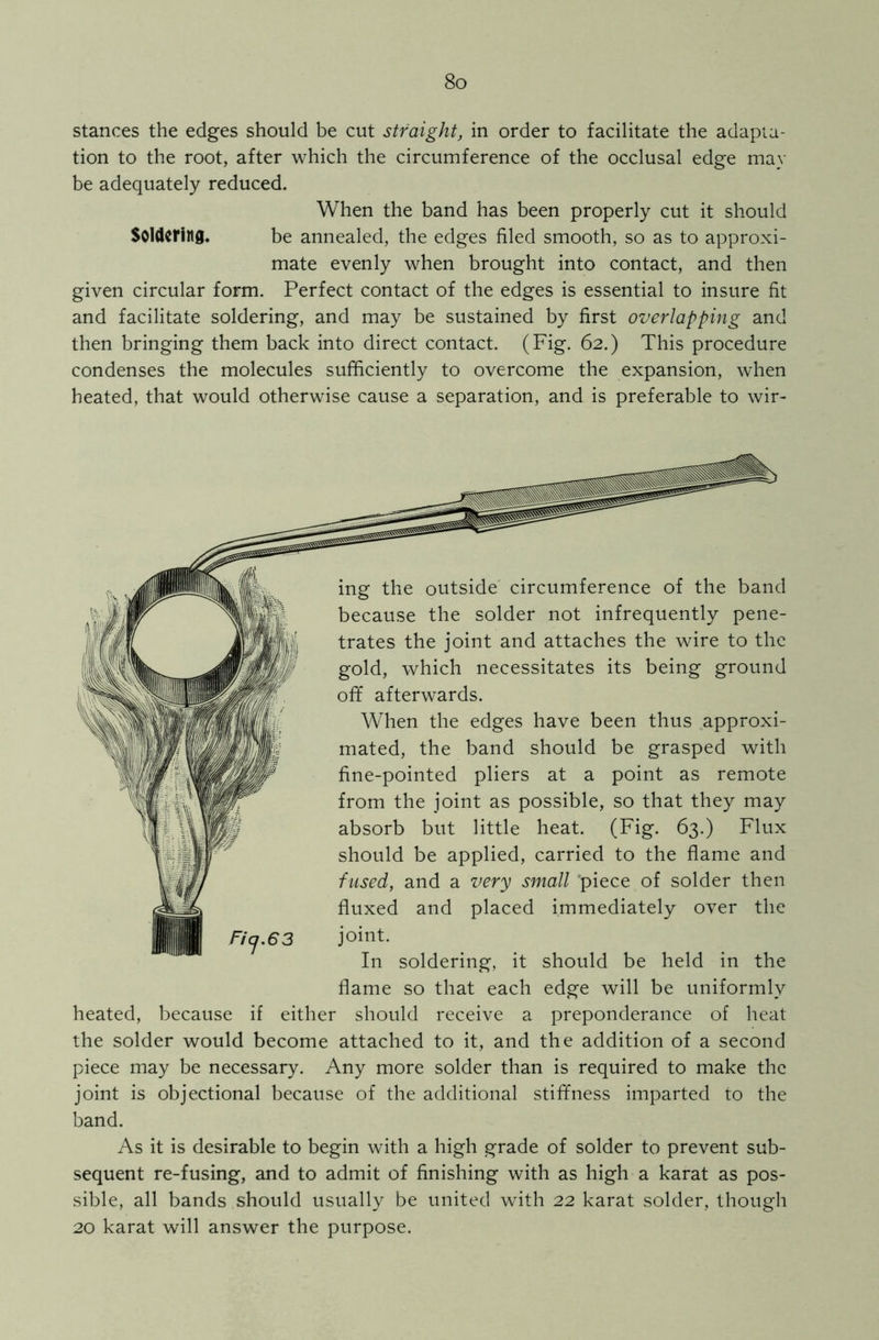 stances the edges should be cut straight, in order to facilitate the adapta- tion to the root, after which the circumference of the occlusal edge may be adequately reduced. When the band has been properly cut it should Soldering. be annealed, the edges filed smooth, so as to approxi- mate evenly when brought into contact, and then given circular form. Perfect contact of the edges is essential to insure fit and facilitate soldering, and may be sustained by first overlapping and then bringing them back into direct contact. (Fig. 62.) This procedure condenses the molecules sufficiently to overcome the expansion, when heated, that would otherwise cause a separation, and is preferable to wir- ing the outside circumference of the band because the solder not infrequently pene- trates the joint and attaches the wire to the gold, which necessitates its being ground off afterwards. When the edges have been thus approxi- mated, the band should be grasped with fine-pointed pliers at a point as remote from the joint as possible, so that they may absorb but little heat. (Fig. 63.) Flux should be applied, carried to the flame and fused, and a very small ‘piece of solder then fluxed and placed immediately over the Ficj.63 joint. In soldering, it should be held in the flame so that each edge will be uniformly heated, because if either should receive a preponderance of heat the solder would become attached to it, and the addition of a second piece may be necessary. Any more solder than is required to make the joint is objectional because of the additional stiffness imparted to the band. As it is desirable to begin with a high grade of solder to prevent sub- sequent re-fusing, and to admit of finishing with as high a karat as pos- sible, all bands should usually be united with 22 karat solder, though 20 karat will answer the purpose.