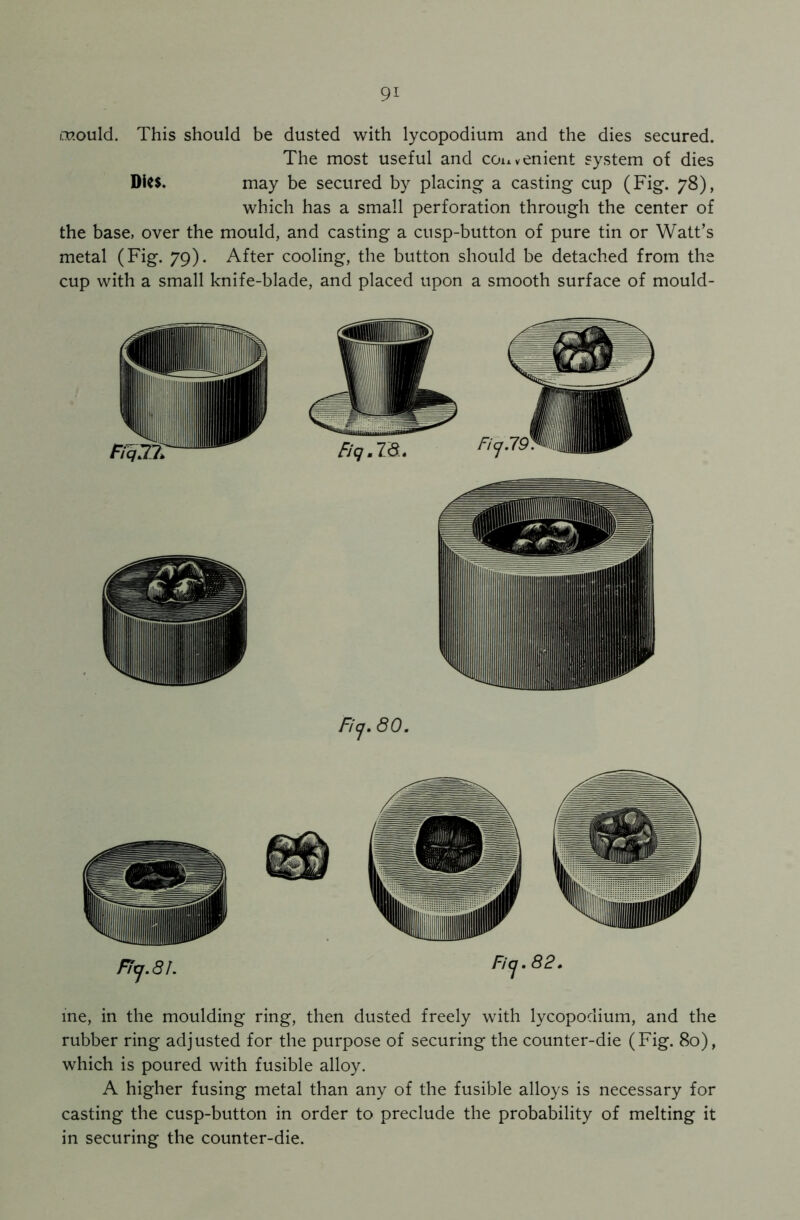 o?.ould. This should be dusted with lycopodium and the dies secured. The most useful and convenient system of dies DiC$. may be secured by placing a casting cup (Fig. 78), which has a small perforation through the center of the base, over the mould, and casting a cusp-button of pure tin or Watt’s metal (Fig. 79). After cooling, the button should be detached from the cup with a small knife-blade, and placed upon a smooth surface of mould- f/g .Id. Ficj. 80. ine, in the moulding ring, then dusted freely with lycopodium, and the rubber ring adjusted for the purpose of securing the counter-die (Fig. 80), which is poured with fusible alloy. A higher fusing metal than any of the fusible alloys is necessary for casting the cusp-button in order to preclude the probability of melting it in securing the counter-die.