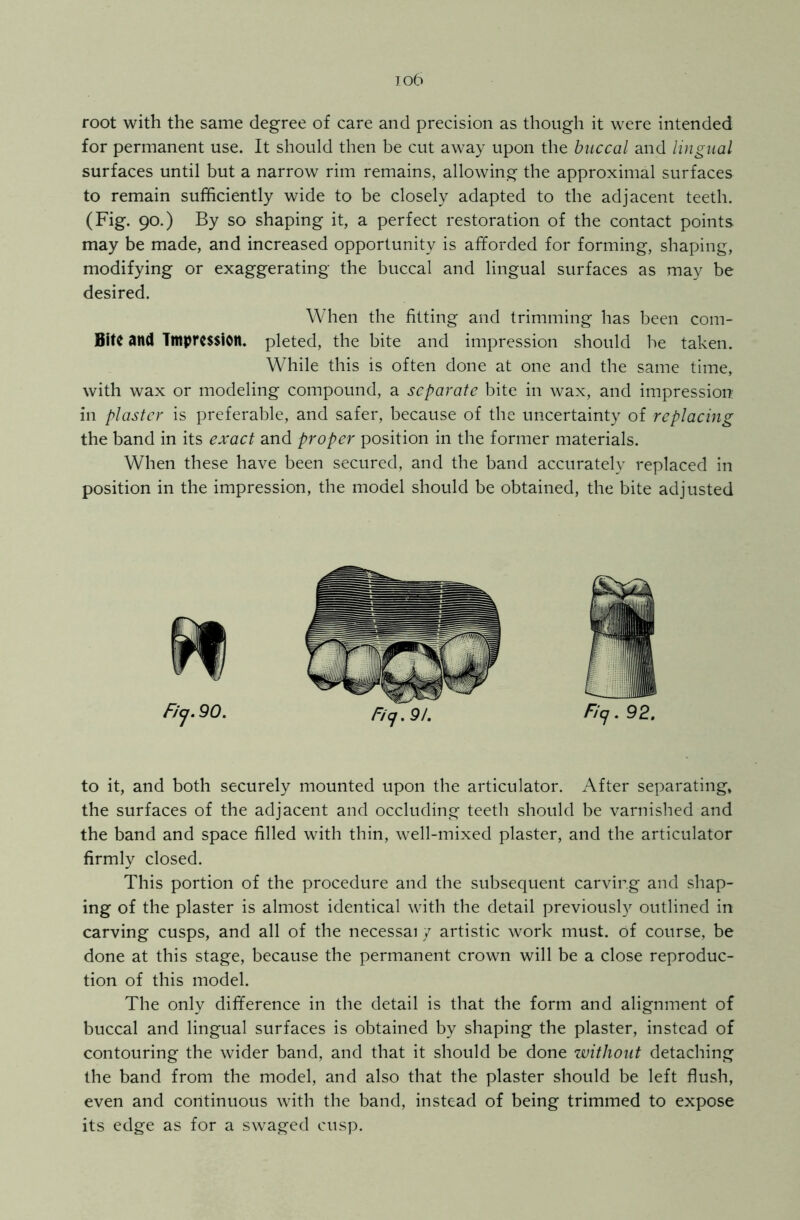 io6 root with the same degree of care and precision as though it were intended for permanent use. It should then be cut away upon the buccal and lingual surfaces until but a narrow rim remains, allowing the approximal surfaces to remain sufficiently wide to be closely adapted to the adjacent teeth. (Fig. 90.) By so shaping it, a perfect restoration of the contact points may be made, and increased opportunity is afforded for forming, shaping, modifying or exaggerating the buccal and lingual surfaces as may be desired. When the fitting and trimming has been com- Bite and Impression, pleted, the bite and impression should be taken. While this is often done at one and the same time, with wax or modeling compound, a separate bite in wax, and impression: in plaster is preferable, and safer, because of the uncertainty of replacing the band in its exact and proper position in the former materials. When these have been secured, and the band accurately replaced in position in the impression, the model should be obtained, the bite adjusted to it, and both securely mounted upon the articulator. After separating, the surfaces of the adjacent and occluding teeth should be varnished and the band and space filled with thin, well-mixed plaster, and the articulator firmly closed. This portion of the procedure and the subsequent carving and shap- ing of the plaster is almost identical with the detail previously outlined in carving cusps, and all of the necessai y artistic work must, of course, be done at this stage, because the permanent crown will be a close reproduc- tion of this model. The only difference in the detail is that the form and alignment of buccal and lingual surfaces is obtained by shaping the plaster, instead of contouring the wider band, and that it should be done without detaching the band from the model, and also that the plaster should be left flush, even and continuous with the band, instead of being trimmed to expose its edge as for a swaged cusp.
