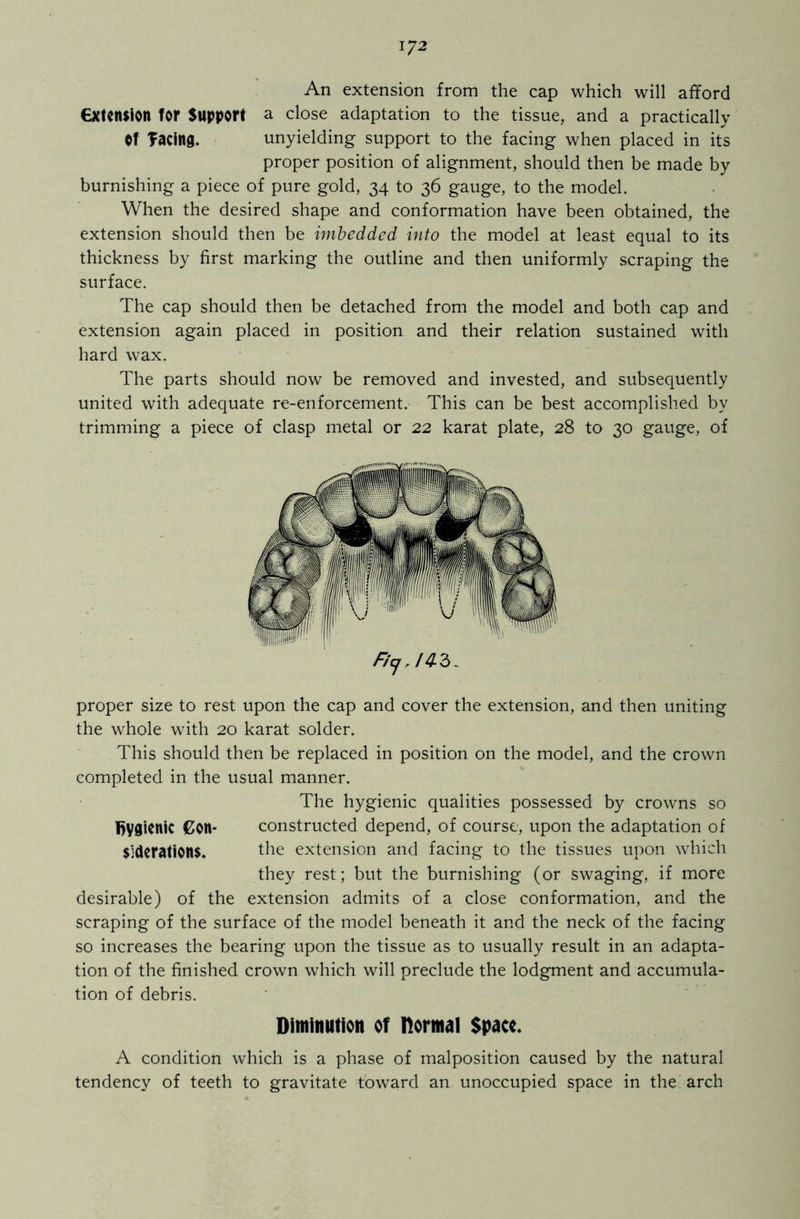 An extension from the cap which will afford extension for Support a close adaptation to the tissue, and a practically Of Tatiltg. unyielding support to the facing when placed in its proper position of alignment, should then be made by burnishing a piece of pure gold, 34 to 36 gauge, to the model. When the desired shape and conformation have been obtained, the extension should then be imbedded into the model at least equal to its thickness by first marking the outline and then uniformly scraping the surface. The cap should then be detached from the model and both cap and extension again placed in position and their relation sustained with hard wax. The parts should now be removed and invested, and subsequently united with adequate re-enforcement. This can be best accomplished by trimming a piece of clasp metal or 22 karat plate, 28 to 30 gauge, of Ficjjq. 3, proper size to rest upon the cap and cover the extension, and then uniting the whole with 20 karat solder. This should then be replaced in position on the model, and the crown completed in the usual manner. The hygienic qualities possessed by crowns so hygienic Con* constructed depend, of course, upon the adaptation of siderations. the extension and facing to the tissues upon which they rest; but the burnishing (or swaging, if more desirable) of the extension admits of a close conformation, and the scraping of the surface of the model beneath it and the neck of the facing so increases the bearing upon the tissue as to usually result in an adapta- tion of the finished crown which will preclude the lodgment and accumula- tion of debris. Diminution of normal Space. A condition which is a phase of malposition caused by the natural tendency of teeth to gravitate toward an unoccupied space in the arch