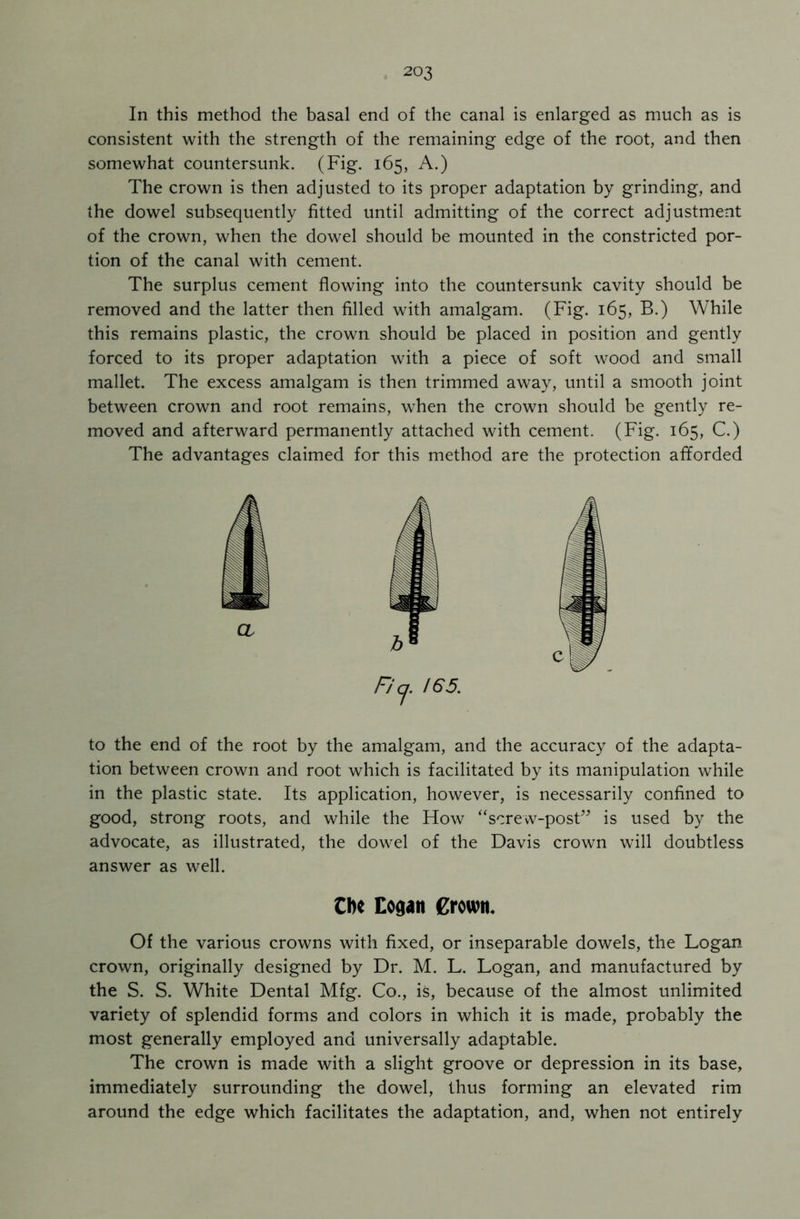 In this method the basal end of the canal is enlarged as much as is consistent with the strength of the remaining edge of the root, and then somewhat countersunk. (Fig. 165, A.) The crown is then adjusted to its proper adaptation by grinding, and the dowel subsequently fitted until admitting of the correct adjustment of the crown, when the dowel should be mounted in the constricted por- tion of the canal with cement. The surplus cement flowing into the countersunk cavity should be removed and the latter then filled with amalgam. (Fig. 165, B.) While this remains plastic, the crown should be placed in position and gently forced to its proper adaptation with a piece of soft wood and small mallet. The excess amalgam is then trimmed away, until a smooth joint between crown and root remains, when the crown should be gently re- moved and afterward permanently attached with cement. (Fig. 165, C.) The advantages claimed for this method are the protection afforded Fi cj. 165. to the end of the root by the amalgam, and the accuracy of the adapta- tion between crown and root which is facilitated by its manipulation while in the plastic state. Its application, however, is necessarily confined to good, strong roots, and while the How “screw-post” is used by the advocate, as illustrated, the dowel of the Davis crown will doubtless answer as well. CIk Cogatt Crown* Of the various crowns with fixed, or inseparable dowels, the Logan crown, originally designed by Dr. M. L. Logan, and manufactured by the S. S. White Dental Mfg. Co., is, because of the almost unlimited variety of splendid forms and colors in which it is made, probably the most generally employed and universally adaptable. The crown is made with a slight groove or depression in its base, immediately surrounding the dowel, thus forming an elevated rim around the edge which facilitates the adaptation, and, when not entirely